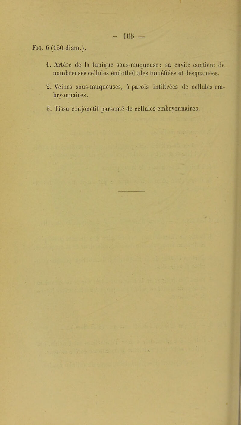 - 106 - FiG. 6(150 diam.). 1. Artère de la tunique sous-muqueuse; sa cavité contient de nombreuses cellules endothéliales tuméfiées et desquamées. 2. Veines sous-muqueuses, à parois infiltrées de cellules em- bryonnaires.