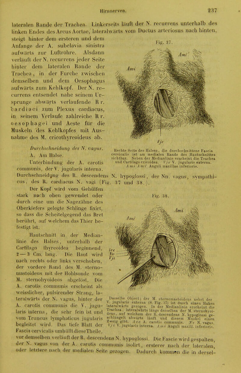 Bechte Seite des Halses, die durchschnittene Fascia cervicalis ist am medialen Rande des Hautschnittes .sichtbar. Neben der Medianlinie erscheint die Trachea und Cartilago crieoidea. 7je V. jugularis externa. A mi Ami' Anguli inaxillae inferioris. N. hypoglossi, der Nn. 37 und 3 8. ). vagus, sympathi- lateralen Rande der Trachea. Linkerseits lauft der N. recurrens unterhalb des linken Endes des Arcus Aortae,' laleralwärts vom Ductus arteriosus nach hinten, Steigt hinter dem erslercn und dein Anfange der A. subclavia sinistra aufwärts zur Luftröhre. Alsdann verläuft derN. recurrens jeder Seile hinter dem lateralen Rande der Trachea, in der Furche zwischen demselben und dem Oesophagus aufwärts zum Kehlkopf. Der N. re- currens entsendet nahe seinem Ur- sprünge abwärts verlaufende R r. 'cardiaci zum Plexus cardiacus, in seinem Verlaufe zahlreiche R r. oesophagei und Aeste für die Muskeln 'des Kehlkopfes mit Aus- nahme des M. cricothyreoideus ab. Durchschneidunq des N. vagus. A. Am Halse. Unterbindung der A. carotis communis, derV. jugularis interna. Durchschneidung des R. descendens cus, des R. cardiacus N. vagi (Fig Der Kopf wird vom Gehülfen stark nach oben gewendet oder durch eine um die Nagezähne des Oberkiefers gelegte Schlinge fixirt, so dass die Scheitelgegend das Bret berührt, auf welchem das Thier be- festigt ist. Hautschnitt in der Median- linie des Halses, unterhalb der Cartilago thyreoidea beginnend, 2 — 3 Cm. lang. Die Haut wird nach rechts oder links verschoben, der vordere Hand des M. sterno- mastoideus mit der Hohlsonde vom M. sternohyoidens abgelöst. Die A. carotis communis erscheint als weisslicher, pulsirender Strang, la- teralwärts der N. vagus» hinter der A. carotis communis die V. jugu- laris interna , die sehr fein ist und vom Truncus lympliaticus jugularis begleitet wird. Das tiefe Blatt der Fascia cervicalis umhüllt dieseTheile, \or demselben verlauf) dcrB. descendens N. hypoglossi. Die Fascie wird gespalten, der \. vagus von der A. carotis eo uinis isnlirt , erstem- nach der' lateralen' oder letztere nach der medialen Seite gezogen. Dadurch kommrn die in dersel- Fig. 38. Dasselbe Ohject; der M. stefnomastoideus nebst der V. jugularis externa (S. Fig. 37) ist durch einen Haken lateralwarts gezogen. In der Medianlinie erscheint die Trachea, lateralwarts längs derselben der M. sternohyoi- deus, auf welchem der R. descendens N. hypoglossi ge- schlängelt abwiirts läuft und diesem Muslte] einen Zweig gibt. Are A. carotis communis. Ar N. vagus P>? V. jugularis interna. Amt Anguli maxiU. inferioris.