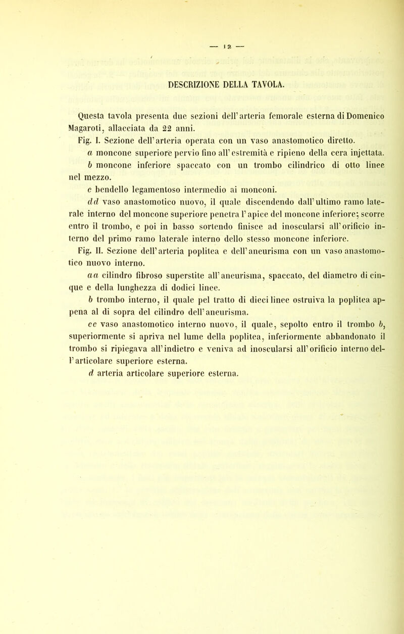 DESCRIZIONE DELLA TAVOLA. Questa tavola presenta due sezioni dell’arteria femorale esterna di Domenico Magaroti, allacciata da 22 anni. Fig. I. Sezione dell’arteria operata con un vaso anastomotico diretto. a moncone superiore pervio fino all’estremità e ripieno della cera injettata. b moncone inferiore spaccato con un trombo cilindrico di otto linee nel mezzo. e bendello legamentoso intermedio ai monconi. dd vaso anastomotico nuovo, il quale discendendo dall’ultimo ramo late- rale interno del moncone superiore penetra l’apice del moncone inferiore; scorre entro il trombo, e poi in basso sortendo finisce ad inoscularsi all’orificio in- terno del primo ramo laterale interno dello stesso moncone inferiore. Fig. IL Sezione dell’arteria poplitea e dell’aneurisma con un vaso anastomo- tico nuovo interno. a a cilindro fibroso superstite all’aneurisma, spaccalo, del diametro di cin- que e della lunghezza di dodici linee. h trombo interno, il quale pel tratto di dieci lince ostruiva la poplitea ap- pena al di sopra del cilindro dell’aneurisma. ce vaso anastomotico interno nuovo, il quale, sepolto entro il trombo 6, superiormente si apriva nel lume della poplitea, inferiormente abbandonato il trombo si ripiegava all’indietro e veniva ad inoscularsi all’orificio interno del- l’articolare superiore esterna. d arteria articolare superiore esterna.