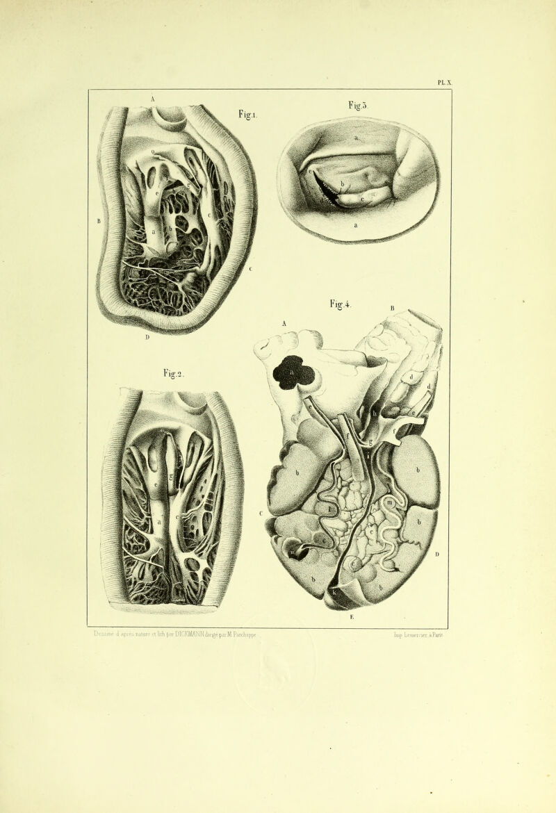 PL.X. Dessillé d après nature ellith parDlCKMANN.dm^épai'M.Paichappi lmp Leineraer.àParis