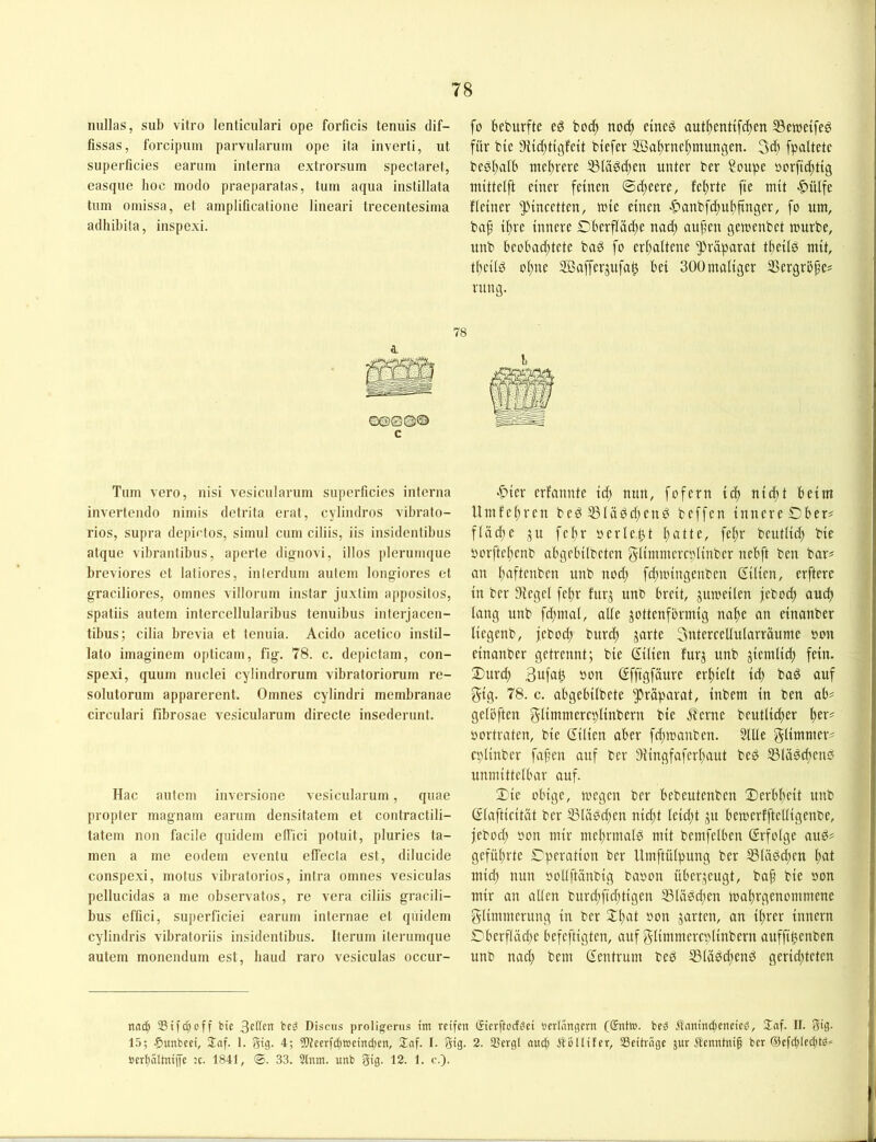nullas, sub vitro lenticulari ope forficis teniiis dif- fissas, forcipum parvnlarum ope ita inverti, ut superficies eariim interna extrorsuin spectaret, easque hoc modo praeparatas, tum aqua instillata tum omissa, et amplificatione lineari trecentesima adhibila, inspexi. ©@0©© c Tum vero, nisi vesicularum superficies interna invertendo nimis detrita erat, cylindros vibrato- rios, supra depictos, simul cnm ciliis, iis insidentibus atque vibrantibus, aperte dignovi, illos plerumque breviores et latiores, inlerdum aiiteni longiores et graciliores, omnes villorum instar juxtini appositos, spatiis autem intercellularibus tenuibus interjacen- tibus; cilia brevia et tenuia. Acido acetico instil- lato imaginem opticam, fig. 78. c. depictam, con- spexi, quum nnclei cylindrorum vibratoriorum re- solutorum apparerent. Omnes cylindri membranae circulari fibrosae vesicularum directe insederunt. Hac autem inversione vesicularum, quae propter magnam earum densitatem et contractili- tatem non facile quideni elTici potuit, pluries ta- rnen a me eodem eventu elfecta est, dilucide conspexi, motus vibratorios, intra omnes vesiculas pellucidas a me observatos, re vera ciliis gracili- bus effici, superficiei earum internae et quideni cylindris vibratoriis insidentibus. Iterum iterumque autem monendum est, liaud raro vesiculas occur- fü bcburfte eö boc^ no(^ eineö aut^entifc^en ^Bettseife^ für btc Dltdjtigfeit btefer 2Bal)rnel^mungen. 3ü) fpaltetc bee^alb meltrere 33läöc()cn unter ber Soupe »orfic^ttg niittelft einer feinen ©d;eere, fe^rte fie mit ^ülfe fieiner ^ineetten, une einen ■C'anbfd;ubftnger, fo um, ba^ if}re innere Dberfiädte nat^ aufen gemenbet mürbe, unb beobad;tete baö fo eri)altene “Jiräparat tbeilö mit, tbeild o^ne SBafferjufa^ bei 300maliger SSergröpe« rung. l «f)ier erfannte id; nun, fofern id) nidtt beim Umfel;ren beö®Iädd;enb beffen innere Ober# flädte ju febr oerle.^t ^atte, fel;r beutUd) bie oorftel;enb abgebilbeten glimmercpiinber nebft ben bar# on ()aftenben unb nod; fd;mingenben ßilien, erfterc in ber Diegel fe^r fur^ imo breit, jumeilen jebod) aud) lang unb fd;ma(, alte jottenfbrmig na^e an einanber liegenb, jebod; burc^ jarte 3tdercellularräume »on einanber getrennt; bie gilien furj unb jiemlid) fein. 3)urd; bon gffigfäure erhielt id) baö auf gig. 78. c. abgebübete Präparat, inbem in ben ab# gelöften glimmereplinberu bie .flerne beutli^er l)er# »ortraten, bie gilien aber fd)manben. SUle glimmer# cplinber fafen auf ber 9iingfaferl)aut beg ®Iäöc^ens? unmittelbar auf. Oie obige, megen ber bebeutenben Oerbl^eit unb glaftieität ber S3lä0d)en nid)t leid)t ju bemerfftetligenbe, jebod) »on mir mel)rmal0 mit bemfelben grfolge auö# gefü()rte Operation ber Umftülpung ber S3lä0d)en ftat mid) nun »ollftünbig baoon überzeugt, ba§ bie »on mir an allen burd)fid)tigen ®lä0d;en maltrgenommene glimmerung in ber 2:i)at »on jarten, an il)rer innern Oberfläd)e befeftigten, auf glimmercplinberu auffi^enben unb nac^ bem gentrum beb S3la0d)enb gerid)teten na(| Sifcbüff bie bcg Discus proligems im reifen (Sierftoef^ei »eriangern (®ntm. beg .Üanindjeneicö, Snf. II. 3ig. 15; $unbeei, 2af. 1. gig. 4; iPteerfd^weim^en, Jcif. I. gig. 2. 3Sergl and) ÄiSllifer, SScitviige Äenntni§ ber ©efc^ieditd^ »ert)5ltni|Te ;c. 1841, ©. 33. 3lnm. unb gig. 12. 1. c.).