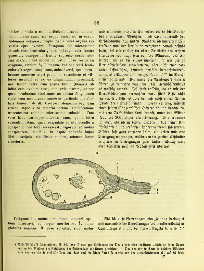 ediderat, modo a me interfectam, dissecui et non- nihil miratus sum, me neqiie vesiculas, in cavum abdominis delapsas, neque ovula intra organa se- xualia ejus invenire. Postquam sub microscopio et sub vitro lenticulari, pedi infixo, ovula frustra quaesivi, denique in triente supremo cornu ute- rini dextri, haud procul ab ostio tubae vesiculam exiguam, vixdum ’// longam, vel ope vitri lenti- cularis^) aegre conspicuam, animadverti, quae mem- branae mucosae uteri paululum vasculosae et vil- losae incubuit et ex ea aliquantulum prominuit, nec tarnen infra eam posita fuit, Quamvis ab initio eam ovulum esse, non existimarem, quippe quae membranae uteri mucosae adnata fuit, tarnen simul cum membranae mucosae particula ope for- ficis tenuis, ab ill. Cooper denominatae, eam resecui atque vitro tectorio tectam, amplificatione trecentesima adhibita microscopio submisi. Tum vero haud parumper attonitus sum, quum intra vesiculam istam, quae exiguitate et situ occulto a conspectu meo fere recesserat, vigorem et motus conspicerem, motibus, in capite secundo hujus libri descriptis, simillimos quidem, attamen longe vivaciores. xtnb tüunbevte miä), tn iftm webet bte tn bte 35auc^= l)öl)te gefallenen 55läöc|en, noc^ ®er tnnerl^alb bet ju ftnben. S'tat^bent {cb unter bent WIU froffope unb bet ^Irmloupe »ergebend banac^ gefu(|t patte, fiel tnir enbKcp int obern 3)nttpe{Ie beg rechten Uterugporneg, nicpt fern öon ber SÜJünbung beg QU letterö, ein tn bie etwaö injidrte unb fepr jottige Uteruöfcpleimpaut eingebettetes, aber nicpt etwa bar= unter beftnblicpeS, fonbern gewölbt persorftepenbeS, winjigeS SSläScpen auf, welcpeS faum y/ ttn 2)urcp# nteffer patte unb felbft unter ber Slrmloupe) äuperft fcpwer ju bewerfen war, weil bie UteruSfcpleiwpaut es wulftig umgab. 3d) pielt baffelbe, ba eS mit ber UteruSf(pleimpaut »erwacpfen war, für’S ©rfte ni(pt für ein ßi, lüfte eS aber bennocp nebft einem fleinen ©tücfe ber UteruSfcpleimpaut, woran eS ping, mittelft einer feinen Sooper’ftpen ©cpeere ab unb bracpte eS, mit bem 2)ecfgläScpen fanft bebecft, unter baS Sliifro# ffop, bei SOOmaliger Vergrößerung. 2Öie erftaunte icp aber, als icp in biefem VläScpcn, baS feiner Un^ fcpeinbarfeit unb oerftedten Lagerung wegen fiep meinen Vliefen faft ganj entjogen patte, ein Seben unb eine Bewegung waprnapm, welcpe ben tm ^weiten Slbfcpnitte befepriebenen Bewegungen jwar üußerft äpnlicp war, aber biefelben noep an Sebpaftigfeit übertraf. Postquam hos motus per aliquod temporis Spa- tium observavi, et corpus moriforme, b, atque globulos minores, ll, sese rotantes, sicut motus SllS i(p biefe Bewegungen eine Beitlang beobaiptet unb namentlich bie Umwälzungen beS maulbeeräpnlicpen ßentralförperS b unb ber fleinen Äugeln h, fowie bie ) (Äamtubcnci, 85. 90.) tft man jur Stufftnbung ber £)uula bmb tm Uteruö „atlein an feine 5tngen mtb an bte üOtetbobe beb Stbfe^abenb bet ©ctileimbaut beb Utevub getniefen.“ — 2)ab »on mir im Serte befc^riebene asiabc^en batte bagegen eine fo berjtccfte Sage unb jtacb nuc^ in feiner garbe fo trenig bon ber Uterubf(|leim|)aut ab, baß i(| feine 13