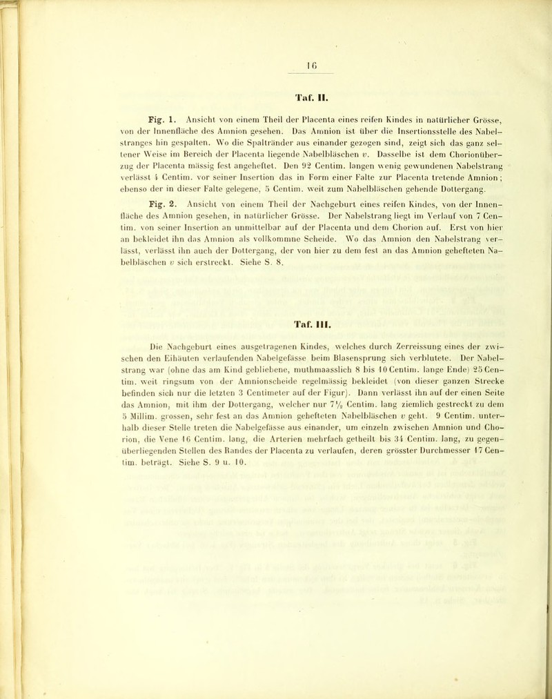 Tat. 11. Fig. 1. Ansicht von einem Theil der Placenla eines reifen Kindes in natürlicher Grösse, von der Innenfläche des Amnion gesehen. Das Amnion ist über die Inserlionsstelle des Nabel- stranges hin gespalten. Wo die Spaltränder aus einander gezogen sind, zeigt sich das ganz sel- tener Weise im Bereich der Placenta liegende Nabelbläschen v. Dasselbe ist dem Chorionüber- zug der Placenta mässig fest angeheflet. Den 92 Centim. langen wenig gewundenen Nabelstrang verlässt 4 Centim. vor seiner Insertion das in Form einer Falte zur Placenta tretende Amnion; ebenso der in dieser Falte gelegene, 5 Centim. weit zum Nabelbläschen gehende Dottergang. Fig. 2. Ansicht von einem Theil der Nachgeburt eines reifen Kindes, von der Innen- fläche des Amnion gesehen, in natürlicher Grösse. Der Nabelstrang liegt im Verlauf von 7 Cen- tim. von seiner Insertion an unmittelbar auf der Placenta und dem Chorion auf. Erst von hier an bekleidet ihn das Amnion als vollkommne Scheide. Wo das Amnion den Nabelstrang ver- lässt, verlässt ihn auch der Dottergang, der von hier zu dem fest an das Amnion gehefteten Na- belbläschen v sich erstreckt. Siehe S. 8. Taf. III. Die Nachgeburt eines ausgetragenen Kindes, welches durch Zerreissung eines der zwi- schen den Eihäuten verlaufenden Nabelgefässe beim Blasensprung sich verblutete. Der Nabel- strang war (ohne das am Kind gebliebene, muthmaasslich 8 bis 10 Centim. lange Ende) 25 Cen- tim. weit ringsum von der Amnionscheide regelmässig bekleidet (von dieser ganzen Strecke befinden sich nur die letzten 3 Centimeter auf der Figur). Dann verlässt ihn auf der einen Seite das Amnion, mit ihm der Dottergang, welcher nur 7% Centim. lang ziemlich gestreckt zu dem 5 Millim. grossen, sehr fest an das Amnion gehefteten Nabelbläschen v geht. 9 Centim. unter- halb dieser Stelle treten die Nabelgefässe aus einander, um einzeln zwischen Amnion und Cho- rion, die Vene 16 Centim. lang, die Arterien mehrfach getheilt bis 34 Centim. lang, zu gegen- überliegenden Stellen des Randes der Placenta zu verlaufen, deren grösster Durchmesser 17 Cen- tim. beträgt. Siehe S. 9 u. 10.