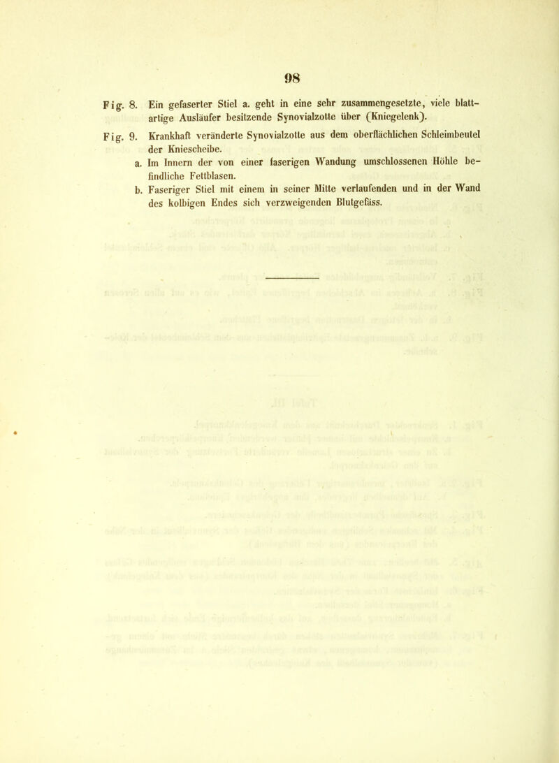 Fig. 8. Ein gefaserter Stiel a. geht in eine sehr zusammengesetzte, viele blatt- artige Ausläufer besitzende Synovialzotte über (Kniegelenk). Fig. 9. Krankhaft veränderte Synovialzotte aus dem oberflächlichen Schleimbeutel der Kniescheibe. a. Im Innern der von einer faserigen Wandung umschlossenen Höhle be- findliche Fettblasen. b. Faseriger Stiel mit einem in seiner Mitte verlaufenden und in der Wand des kolbigen Endes sich verzweigenden Blutgefäss.