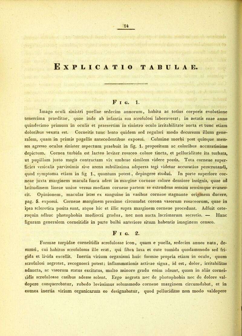 Explicatio tabulae. F I G. 1. Imago oculi sinistri puellae sedecim annorum, habitu ac totius corporis evolutione tenerrima praeditae, quae inde ab infantia sua scrofulosi laboraverat; in aetatis suae anno quindecimo primum in oculis et praesertim in sinistro oculo irritabilitate aucta et tunc etiam doloribus vexata est. Corneitis tunc lento quidem sed regulari modo decursum illum gene- ralem, quam in primis pagellis antecedentibus exposui. Culmine morbi post quinque men- ses agresso oculus sinister aspectum praebuit in fig. 1. propositum ac coloribus accuratissime depictum. Cornea turbida est lacteo leviter rosaceo colore tincta, et pelluciditate ita turbata, ut pupillam justo magis contractam vix umbrae similem videre possis. Tota corneae super- ficies vesicalis parvissimis sive arena subtilissima adspersa tegi videtur accuratius perscrutandi, quod symptoma etiam in fig 1., quantum potest, depingere studui. In parte superiore cor- neae juxta marginem macula fusca adest in margine corneae colore densiore insignis, quae ad latitudinem lineae unius versus mediam corneae partem se extendens sensim sensimque evanes- cit. Opinionem, maculas istas ex sanguine in vasibus corneae stagnante originem ducere, pag. 5. exposui. Corneae marginem proxime circumdat corona vasorum rosaceorum, quae in ipsa sclerotica posita sunt, atque hic et illic supra marginem corneae procedunt. Adfuit cete- roquin adhuc photophobia mediocri gradus, nec non aucta lacrimarum secretio. — Hanc figuram generalem corneitidis in parte bulbi anteriore situm habentis imaginem censeo. Fig. 2. Formae torpidae corneitidis scrofulosae icon, quam e puella, sedecim annos nata, de- sumsi, cui habitus scrofulosus ille erat, qui fibra laxa et cute tumida quodammodo sed fri- gida et livida excellit. Inertia virium organismi huic formae propria etiam in oculo, quum scrofulosi aegrotet, recognosci potest; inflammationis activae signa, id est, dolor, irritabilitas adaucta, ac vasorum status excitatus, multo minore gradu enim adsunt, quam in aliis cornei- tidis scrofulosae casibus adesse solent. Ergo aegrota nec de photophobia nec de dolore val- dopere conquerebatur, rubedo levissimus solummodo corneae marginem circumdabat, et in cornea inertia virium organicarum eo designabatur, quod pelluciditas non modo valdopere