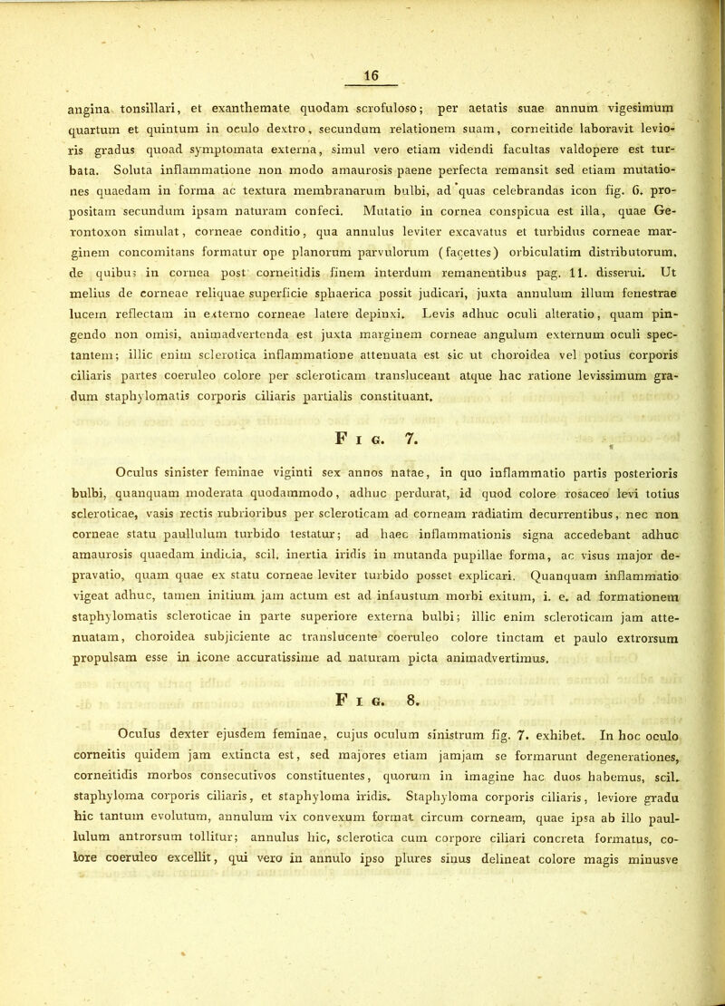 angina tonsillari, et exanthemate quodam scrofuloso; per aetatis suae annum vigesimum quartum et quintum in oeulo dextro, secundum relationem suam, corneitide laboravit levio- ris gradus quoad symptomata externa, simul vero etiam videndi facultas valdopere est tur- bata. Soluta inflammatione non modo amaurosis paene perfecta remansit sed etiam mutatio- nes quaedam in forma ac textura membranarum bulbi, ad quas celebrandas icon fig. 6, pro- positam secundum ipsam naturam confeci. Mutatio in cornea conspicua est illa, quae Ge- rontoxon simulat, corneae conditio, qua annulus leviter excavatus et turbidus corneae mar- ginem concomitans formatur ope planorum parvulorum (facettes) orbiculatim distributorum, de quibus in cornea post corneitidis finem interdum remanentibus pag. 11. disserui. Ut melius de corneae reliquae superficie sphaerica possit judicari, juxta annulum illum fenestrae lucem reflectam in externo corneae latere depinxi. Levis adhuc oculi alteratio, quam pin- gendo non omisi, animadvertenda est juxta marginem corneae angulum externum oculi spec- tantem; illic enim sclerotica inflammatione attenuata est sic ut choroidea vel potius corporis ciliaris partes coeruleo colore per scleroticam transluceant atque hac ratione levissimum gra- dum staphylomatis corporis ciliaris partialis constituant. Fig. 7. Oculus sinister feminae viginti sex annos natae, in quo inflammatio partis posterioris bulbi, quanquam moderata quodammodo, adhuc perdurat, id quod colore rosaceo levi totius scleroticae, vasis rectis rubrioribus per scleroticam ad corneam radiatim decurrentibus, nec non corneae statu paullulum turbido testatur; ad haec inflammationis signa accedebant adhuc amaurosis quaedam indicia, scii, inertia iridis in mutanda pupillae forma, ac visus major de- pravatio, quam quae ex statu corneae leviter turbido posset explicari, Quanquam inflammatio vigeat adhuc, tamen initium jam actum est ad infaustum morbi exitum, i. e. ad formationem staphylomatis scleroticae in parte superiore externa bulbi; illic enim scleroticam jam atte- nuatam, choroidea subjiciente ac translucente coeruleo colore tinctam et paulo extrorsum propulsam esse in icone accuratissime ad naturam picta animadvertimus. Fig. 8. Oculus dexter ejusdem feminae, cujus oculum sinistrum fig. 7. exhibet. In hoc oculo corneitis quidem jam extincta est, sed majores etiam jamjam se formarunt degenerationes, corneitidis morbos consecutivos constituentes, quorum in imagine hac duos habemus, sciL stapliyloma corporis ciliaris, et staphyloma iridis. Staphyloma corporis ciliaris, leviore gradu hic tantum evolutum, annulum vix convexum format circum corneam, quae ipsa ab illo paul- lulum antrorsum tollitur; annulus hic, sclerotica cum corpore ciliari concreta formatus, co- lore coeruleo excellit, qui vero in annulo ipso plures sinus delineat colore magis minusve