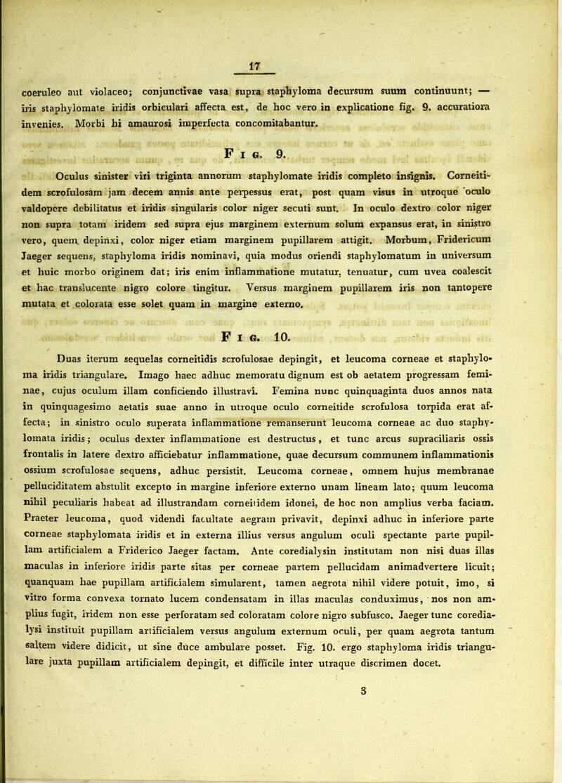 lr coeruleo aut violaceo; conjunctivae vasa supra staphyloma decursum suum continuunt; — iris staphylomate iridis orbiculari affecta est, de hoc vero in explicatione fig. 9. accuratiora invenies. Morbi hi amaurosi imperfecta concomitabantur. Fig. 9. Oculus sinister viii triginta annorum staphylomate iridis completo insignis. Corneiti- dem scrofulosam jam decem annis ante perpessus erat, post quam visus in utroque 'oculo valdopere debilitatus et iridis singularis color niger secuti sunt. In oculo dextro color niger non supra totam iridem sed supra ejus marginem externum solum expansus erat, in sinistro vero, quem, depinxi, color niger etiam marginem pupillarem attigit. Morbum, Fridericum Jaeger sequens, staphyloma iridis nominavi, quia modus oriendi staphylomatum in universum et huic morbo originem dat; iris enim inflammatione mutatur, tenuatur, cum uvea coalescit et hac translucente nigro colore tingitur. Versus marginem pupillarem iris non tantopere mutata et colorata esse solet quam in margine externo. Fig. 10. Duas iterum sequelas corneitidis scrofulosae depingit, et leucoma corneae et staphylo- ma iridis triangulare. Imago haec adhuc memoratu dignum est ob aetatem progressam femi- nae, cujus oculum illam conficiendo illustravi. Femina nunc quinquaginta duos annos nata in quinquagesimo aetatis suae anno in utroque oculo corneitide scrofulosa torpida erat af- fecta; in sinistro oculo superata inflammatione remanserunt leucoma corneae ac duo staphy- lomata iridis; oculus dexter inflammatione est destructus, et tunc arcus supraciliaris ossis frontalis in latere dextro afficiebatur inflammatione, quae decursum communem inflammationis ossium scrofulosae sequens, adhuc persistit. Leucoma corneae, omnem hujus membranae pelluciditatem abstulit excepto in margine inferiore externo unam lineam lato; quum leucoma nihil peculiaris habeat ad illustrandam corneiiidem idonei, de hoc non amplius verba faciam. Praeter leucoma, quod videndi facultate aegram privavit, depinxi adhuc in inferiore parte corneae staphylomata iridis et in externa illius versus angulum oculi spectante parte pupil- lam artificialem a Friderico Jaeger factam. Ante coredialysin institutam non nisi duas illas maculas in inferiore iridis parte sitas per corneae partem pellucidam animadvertere licuit; quanquam hae pupillam artificialem simularent, tamen aegrota nihil videre potuit, imo, si vitro forma convexa tornato lucem condensatam in illas maculas conduximus, nos non am- plius fugit, iridem non esse perforatam sed coloratam colore nigro subfusco. Jaeger tunc coredia- lysi instituit pupillam artificialem versus angulum externum oculi, per quam aegrota tantum saltem videre didicit, ut sine duce ambulare posset. Fig. 10. ergo staphyloma iridis triangu- lare juxta pupillam artificialem depingit, et difficile inter utraque discrimen docet. 3