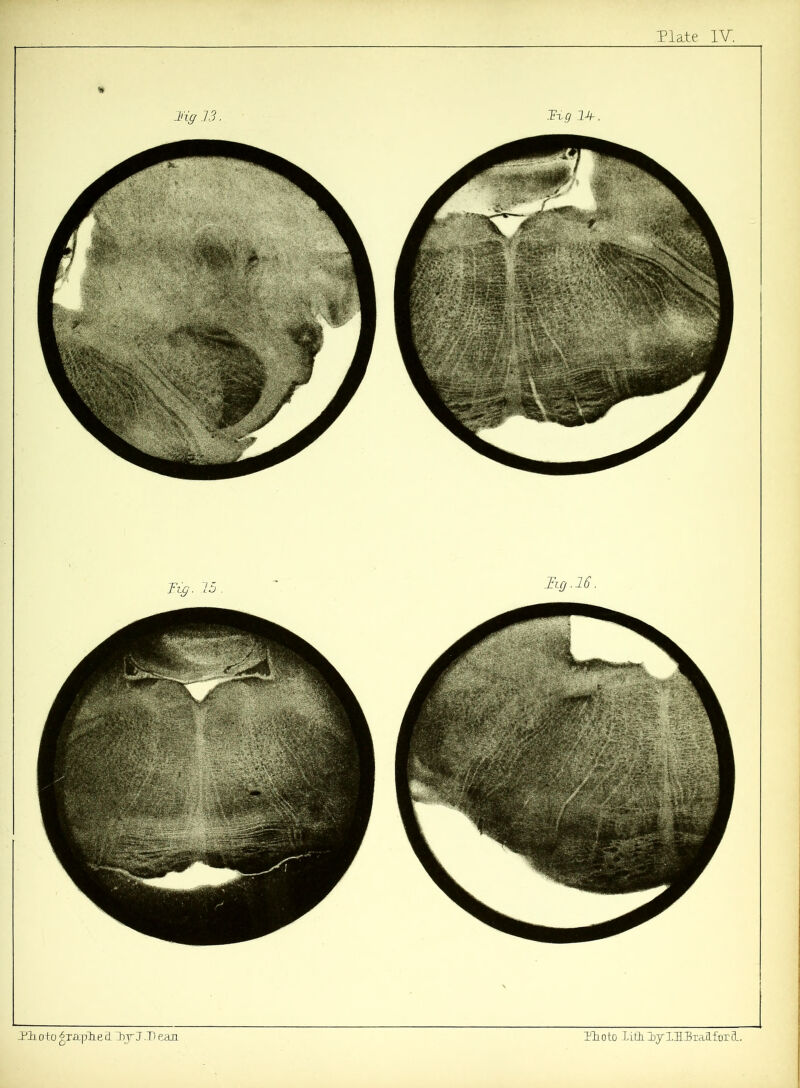 Plaie IV, ZP1 oto prscphe d Zby J .1) eau Ho to Iith.ZbyIlIJxan.for 3L. hg.ie Ti,g 14-.