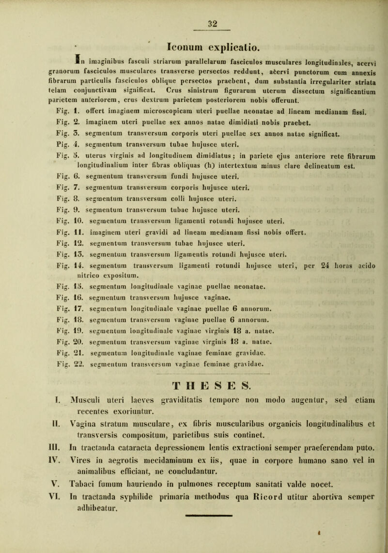 Iconum explicatio. In imaginibus fasculi striarum parallelarum fasciculos musculares longitudinales, acervi granorum fasciculos musculares transverse persectos reddunt, afcervi punctorum cum annexis fibrarum particulis fasciculos oblique persectos praebent, dum substantia irregulariter striata telam conjunctivam significat. Crus sinistrum figurarum uterum dissectum significantium parietem anteriorem, crus dextrum parietem posteriorem nobis offerunt. Fig. i. offert imaginem microscopicam uteri puellae neonatae ad lineam medianam fissi. Fig. 2. imaginem uteri puellae sex annos natae dimidiati nobis praebet. Fig. 3. segmentum transversura corporis uteri puellae sex annos natae significat. Pig. 4. segmentum transversum tubae hujusce uteri. Fig. 5. uterus virginis ad longitudinem dimidiatus; in pariete ejus anteriore rete fibrarum longitudinalium inter fibras obliquas (h) intertextum minus clare delineatum est. Fig. (i. segmentum transversum fundi hujusce uteri. Fig. 7. segmentum transversum corporis hujusce uteri. Fig. 8. segmentum transversum colli hujusce uteri. Fig. 9. segmentum transversum tubae hujusce uteri. Fig. 10. segmentum transversum ligamenti rotundi hujusce uteri. Fig. 11. imaginem uteri gravidi ad lineam medianam fissi nobis offert. Fig. 12. segmentum transversum tubae hujusce uteri. Fig. 15. segmentum transversum ligamentis rotundi hujusce uteri. Fig. 14. segmentum transversum ligamenti rotundi hujusce uteri, per 24 horas acido nitrico expositum. Fig. 15. segmentum longitudinale vaginae puellae neonatae. Fig. 16. segmentum transversum hujusce vaginae. Fig. 17. segmentum longitudinale vaginae puellae 6 annorum. Fig. 18. segmentum transversum vaginae puellae 6 annorum. Fig. 19. segmentum longitudinale vaginae virginis 18 a. natae. Fig. 20. segmentum transversum vaginae virginis 18 a. natae. Fig. 21. segmentum longitudinale vaginae feminae gravidae. Fig. 22. segmentum transversum vaginae feminae gra\idae. THESES. I. Musculi uteri laeves graviditatis tempore non modo augentur, sed etiam recentes exoriuntur. II. Vagina stratum musculare, ex fibris muscularibus organicis longitudinalibus et transversis compositum, parietibus suis continet. III. In tractanda cataracta depressionem lentis extractioni semper praeferendam puto. IV. Vires in aegrotis mecidaminum ex iis, quae in corpore lmmano sano vel in animalibus efficiant, ne concludantur. V. Tabaci fumum hauriendo in pulmones receptum sanitati valde nocet. VI. In tractanda syphilide primaria methodus qua Ricord utitur abortiva semper adhibeatur. t
