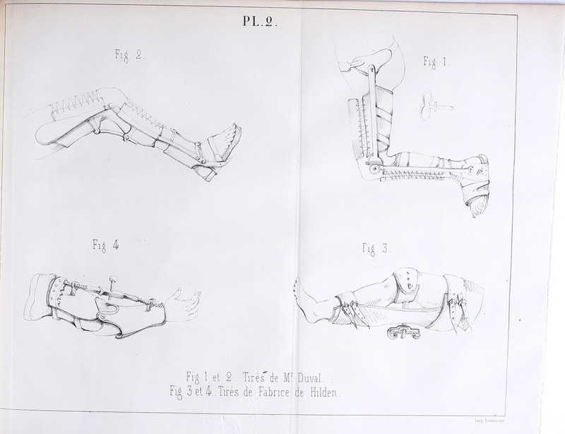 — [mp Lemercicr Fig 1 et 2 . Tirés de Mr Duval. Fig 3 et T. Tirés de Fabrice de Hildea. PL.P I