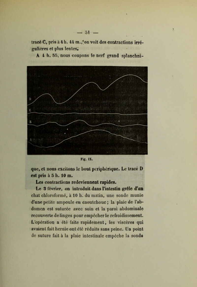 — 31 Iracé C, pris à 4h. 44 m./’on voit des contractions irré- gulières et plus lentes. A 4 h. 55, nous coupons le nerf grand splanchni- Fig. \%. que, et nous excitons le bout périphérique. Le tracé D est pris à 5 h. 10 m. Les contractions redeviennent rapides. Le 3 février, on introduit dans l'intestin grêle d’un chat chloroformé, à 10 h. du malin, une sonde munie d’une petite ampoule eu caoutchouc ; la plaie de l’ab- domen est suturée avec soin et la paroi abdominale recouverte de linges pour empêcher le refroidissement. L'opération a été faite rapidement, les viscères qui avaient fait hernie ont été réduits sans peine. Un point de suture fait à la plaie intestinale empêche la sonda