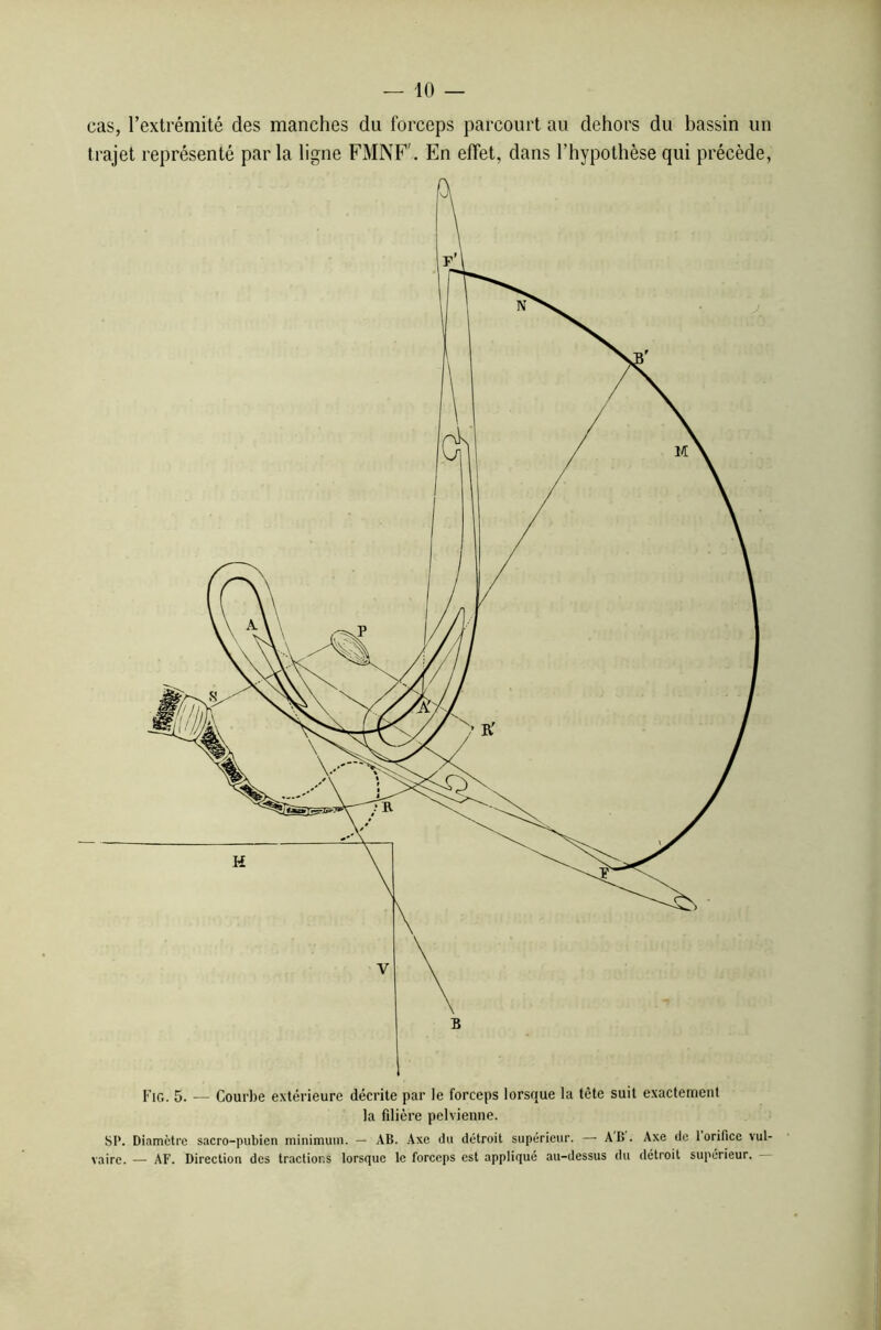 cas, l’extrémité des manches du forceps parcourt au dehors du bassin un trajet représenté parla ligne FMNF'. En effet, dans l’hypothèse qui précède, Fig. 5. — Courbe extérieure décrite par le forceps lorsque la tête suit exactement la filière pelvienne. SP. Diamètre sacro-pubien minimum. — AB. Axe du détroit supérieur. — AB. Axe de 1 orifice vul- vaire. — AF. Direction des tractions lorsque le forceps est appliqué au-dessus du détroit supérieur.