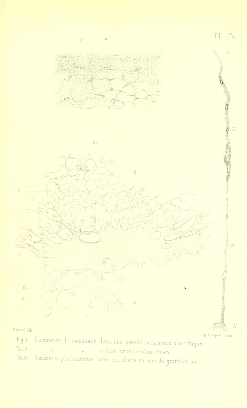 2 Eg.l. %■ 2 ■ Eg.3, Jl FormaHoTi de vaisseaux dans une pseudo-memlirane pleureiicfue « .. artere crurale d'un cluen. Vaisseau plasmalipue inter-cellulaire en voie de qranulation. up .bcccjuei, jdanc .