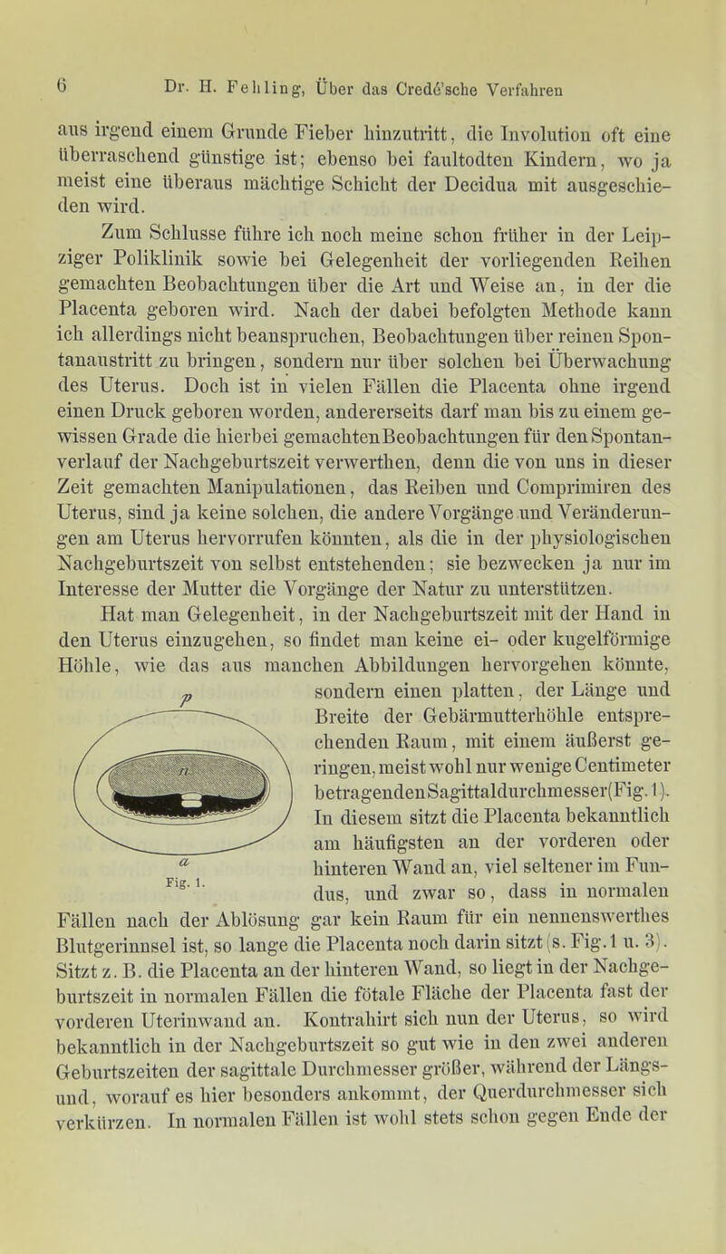 aus irgend einem Grunde Fieber binzutritt, die Involution oft eine überraschend günstige ist; ebenso bei faultodten Kindern, avo ja meist eine überaus mächtige Schicht der Decidua mit ausgeschie- den Avird. Zum Schlüsse führe ich noch meine schon früher in der Leip- ziger Poliklinik soAvie bei Gelegenheit der vorliegenden Reihen gemachten Beobachtungen über die Art und Weise an, in der die Placenta geboren Avird. Nach der dabei befolgten Methode kann ich allerdings nicht beanspruchen, Beobachtungen über reinen Spon- tanaustritt zu bringen, sondern nur über solchen bei ÜberAvachung des Uterus. Doch ist in vielen Fällen die Placenta ohne irgend einen Druck geboren worden, andererseits darf man bis zu einem ge- wissen Grade die hierbei gemachten Beobachtungen für den Spontan- verlauf der Nachgeburtszeit verwerthen, denn die von uns in dieser Zeit gemachten Manipulationen, das Reiben und Comprimiren des Uterus, sind ja keine solchen, die andere Vorgänge und Veränderun- gen am Uterus hervorrufeu könnten, als die in der physiologischen Nachgeburtszeit von selbst entstehenden; sie bezwecken ja nur im Interesse der Mutter die Vorgänge der Natur zu unterstützen. Hat man Gelegenheit, in der Nachgeburtszeit mit der Hand in den Uterus eiuzugehen, so findet man keine ei- oder kugelförmige Höhle, Avie das aus manchen Abbildungen hervorgehen könnte, sondern einen platten, der Länge und Breite der Gebärmutterhöhle entspre- chenden Raum, mit einem äußerst ge- ringen, meist Avohl nur wenige Centimeter betragendenSagittaldurchmesser(Fig. I). In diesem sitzt die Placenta bekanntlich am häufigsten an der vorderen oder hinteren Wand an, viel seltener im Fun- dus, und ZAvar so, dass in normalen Fällen nach der Ablösung gar kein Raum für ein nennenSAverthes Bhitgerinnsel ist, so lange die Placenta noch darin sitzt i s. Fig.l u. 3). Sitzt z. B. die Placenta an der hinteren Wand, so liegt in der Nachge- burtszeit in normalen Fällen die fötale Fläche der Placenta fast der vorderen UterinAvand an. Kontrahirt sich nun der Uterus, so Avird bekanntlich in der Nachgeburtszeit so gut Avie in den zwei anderen Geburtszeiten der sagittale Durchmesser größer, Avährend der Längs- uud, worauf es hier besonders ankommt, der Querdurchmesser sich verkürzen. In normalen Fällen ist Avohl stets schon gegen Ende der
