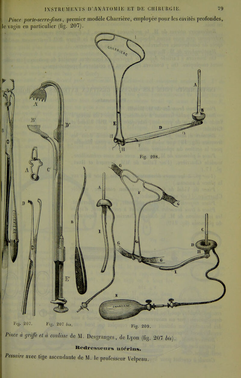 IXSTKUAIKNTS D'AiVATO.UIK liT DM CM I Itl lUi I li. Pince porle-sene-fines, premier modèle Charricrc, employée pour les cavités profond e vayiii en pa iliculier (lig. 207). i'.a. 207. Kijj. 207 b,B. 209. Pince à griffe et à coulisse de M. Desgraiiges, de Lyon (Og. 207 bis). Pessaire avec tige ascendante de M. le professeur Velpeau.