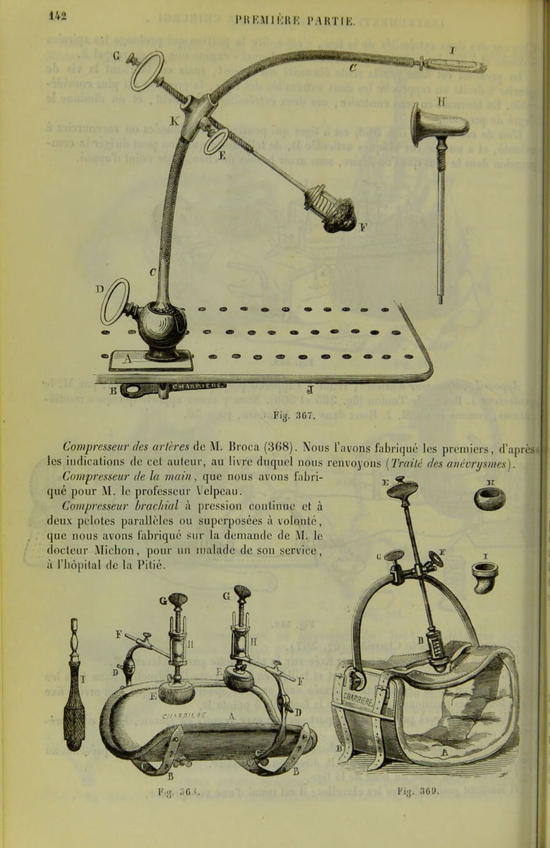 l'ItKMlDHK l'.AHTIK Fig. 367. Compresseur (les artères de M. Broca (368). Nous l'avons fabriqué les premiers, d'après les indications de cet auteur, au livre duquel nous renvoyons [Trailc des anccrijsmes). Compresseur de la main, que nous avons fabri- qué pour M. le professeur Velpeau. Compresseur bracliial à pression continue et à deux pelotes parallèles ou superposées à volonté, que nous avons i'abriquc sur la demande de M. le docteur Alicbon, pour un malade de son service, à riiôpilal de la Pitié.