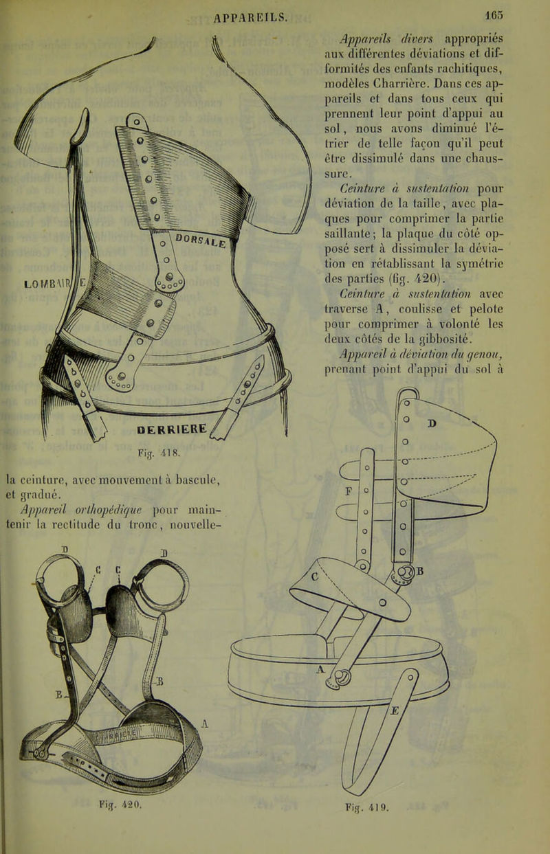 DERRIERE, Fig. 418. la cc'iiilurc, avec moiivcnioiil à l)asculc, et gradué. Appareil orlhopédique pour main- tenir la reclitiidc du tronc, nouvcUe- Appareils divers appropriés aux différentes déviations et dif- formités des enfants rachitiques, modèles Charrière. Dans ces ap- pareils et dans tous ceux qui prennent leur point d'appui au sol, nous avons diminué l'é- Irier de telle façon qu'il peut être dissimulé dans une chaus- sure. Ceinture à s us tenir/lion pour déviation de la taille, avec pla- ques pour comprimer la partie saillante; la plaque du côté op- posé sert à dissimuler la dévia- tion en rétablissant la symétrie des parties (Og. 420). Ceinture à sustentation avec traverse A, coulis.se et pelote pour comprimer à volonté les deux côtés de la gibhosité. Appareil à (léviation du (jenou, prenant point d'appui du sol à Fig. il9.