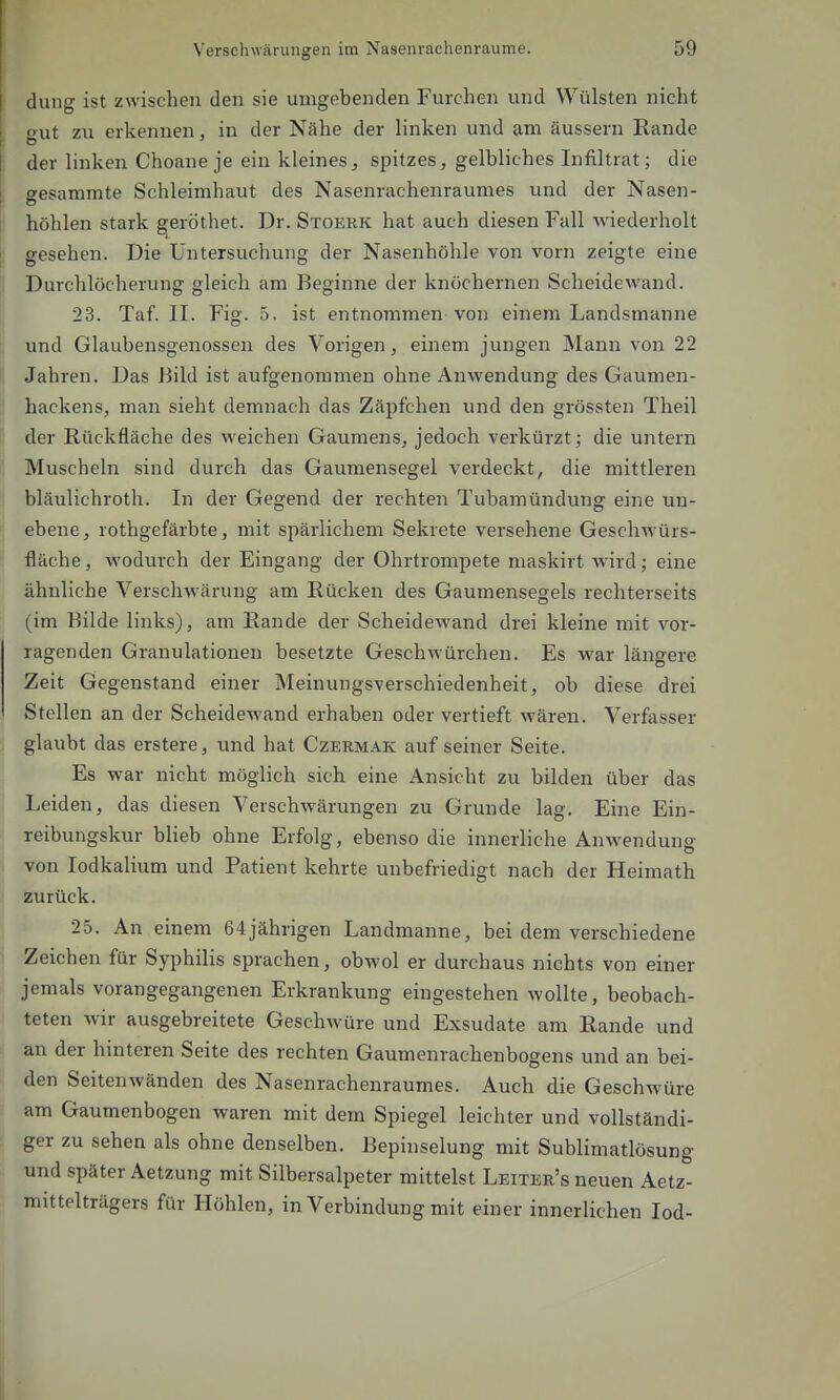 dung ist zwischen den sie umgebenden Furchen und Wülsten nicht eut zu erkennen, in der Nähe der linken und am äussern Rande der linken Choane je ein kleines, spitzes, gelbliches Infiltrat; die gesammte Schleimhaut des Nasenrachenraumes und der Nasen- höhlen stark ^eröthet. Dr. Stoerk hat auch diesen Fall wiederholt gesehen. Die Untersuchung der Nasenhöhle von vorn zeigte eine Durchlöcherung gleich am Beginne der knöchernen Scheidewand. 23. Taf. II. Fig. 5, ist entnommen von einem Landsmanns und Glaubensgenossen des Vorigen, einem jungen Mann von 22 Jahren. Das Bild ist aufgenommen ohne Anwendung des Gaumen- hackens, man sieht demnach das Zäpfchen und den grössten Theil der Rückfläche des weichen Gaumens, jedoch verkürzt; die untern Muscheln sind durch das Gaumensegel verdeckt, die mittleren bläulichroth. In der Gegend der rechten Tubamündung eine un- ebene, rothgefärbte, mit spärlichem Sekrete versehene Geschwürs- fläche , wodurch der Eingang der Ohrtrompete maskirt wird; eine ähnliche Verschwärung am Rücken des Gaumensegels rechterseits (im Bilde links), am Rande der Scheidewand drei kleine mit vor- ragenden Granulationen besetzte Geschwürchen. Es war längere Zeit Gegenstand einer Meinungsverschiedenheit, ob diese drei Stellen an der Scheidewand erhaben oder vertieft wären. Verfasser glaubt das erstere, und hat Czermak auf seiner Seite. Es war nicht möglich sich eine Ansicht zu bilden über das Leiden, das diesen Verschwärungen zu Grunde lag. Eine Ein- reibungskur blieb ohne Erfolg, ebenso die innerliche Anwendung von lodkalium und Patient kehrte unbefriedigt nach der Heimath zurück. 25. An einem 64jährigen Landmanne, bei dem verschiedene Zeichen für Syphilis sprachen, obwol er durchaus nichts von einer jemals vorangegangenen Erkrankung eingestehen wollte, beobach- teten wir ausgebreitete Geschwüre und Exsudate am Rande und an der hinteren Seite des rechten Gaumenrachenbogens und an bei- den Seiten wänden des Nasenrachenraumes. Auch die Geschwüre am Gaumenbogen waren mit dem Spiegel leichter und vollständi- ger zu sehen als ohne denselben. Bephiselung mit Sublimatlösung und später Aetzung mit Silbersalpeter mittelst Leiter's neuen Aetz- mittelträgers für Höhlen, in Verbindung mit einer innerlichen Tod-