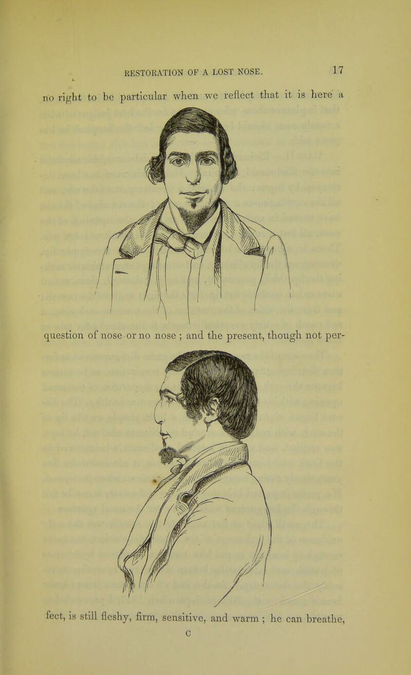 no right to be particular when wc reflect that it is here a question of nose or no nose ; and the present, though not per- fect, is still fleshy, firm, sensitive, and warm ; he can breathe, C