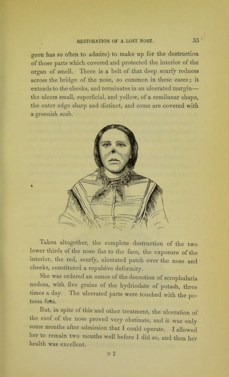 geon has so often to admire) to make up for the destruction of those parts which covered and protected the interior of the organ of smell. There is a belt of that deep scurfy redness across the bridge of the nose, so common in these cases ; it extends to the cheeks, and terminates in an ulcerated margin— the ulcers small, superficial, and yellow, of a semilunar shape, the outer edge sharp and distinct, and some are covered with a greenish scab. Taken altogether, the complete destruction of the two lower thirds of the nose flat to the face, the exposure of the interior, the red, scurfy, ulcerated patch over the nose and cheeks, constituted a repulsive deformity. She was ordered an ounce of the decoction of scrophularia nodosa, with five grains of the hydriodate of potash, three times a day. The ulcerated parts were touched with the po- tassa fusa. But, in spite of this and other treatment, the ulceration of the roof of the nose proved very obstinate, and it was only some months after admission that I could operate. I allowed her to remain two months well before I did so, and then her health was excellent. D 2