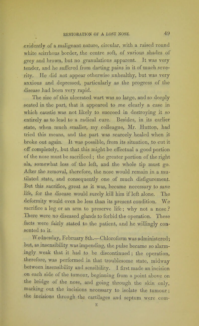 evidently of a malignant nature, circular, with a raised round white scirrhous border, the centre soft, of various shades of grey and brown, but no granulations apparent. It was very tender, and he suffered from darting pains in it of much seve- rity. He did not appear otherwise unhealthy, but was very anxious and depressed, particularly as the progress of the disease had been very rapid. The size of this ulcerated wart was so large, and so deeply seated in the part, that it appeared to me clearly a case in which caustic was not likely to succeed in destroying it so entirely as to lead to a radical cure. Besides, in its earlier state, when much smaller, my colleague, Mr. Hutton, had tried this means, and the part was scarcely healed when it broke out again. It was possible, from its situation, to cut it off completely, but that this might be effectual a good portion of the nose must be sacrificed; the greater portion of the right ala, somewhat less of the left, and the whole tip must go. After the removal, therefore, the nose would remain in a mu- tilated state, and consequently one of much disfigurement. But this sacrifice, great as it was, became necessary to save life, for the disease would surely kill him if left alone. The deformity would even be less than its present condition. We sacrifice a leg or an arm to preserve life; why not a nose ? There were no diseased glands to forbid the operation. These facts were fairly stated to the patient, and he willingly con- sented to it. Wednesday, February 8th.—Chloroform was administered; but, as insensibility was impending, the pulse became so alarm- ingly weak that it had to be discontinued; the operation, therefore, was performed in that troublesome state, midway between insensibility and sensibility. I first made an incision on each side of the tumour, beginning from a point above on the bridge of the nose, and going through the skin only, marking out the incisions necessary to isolate the tumour; the incisions through the cartilages and septum were com- E