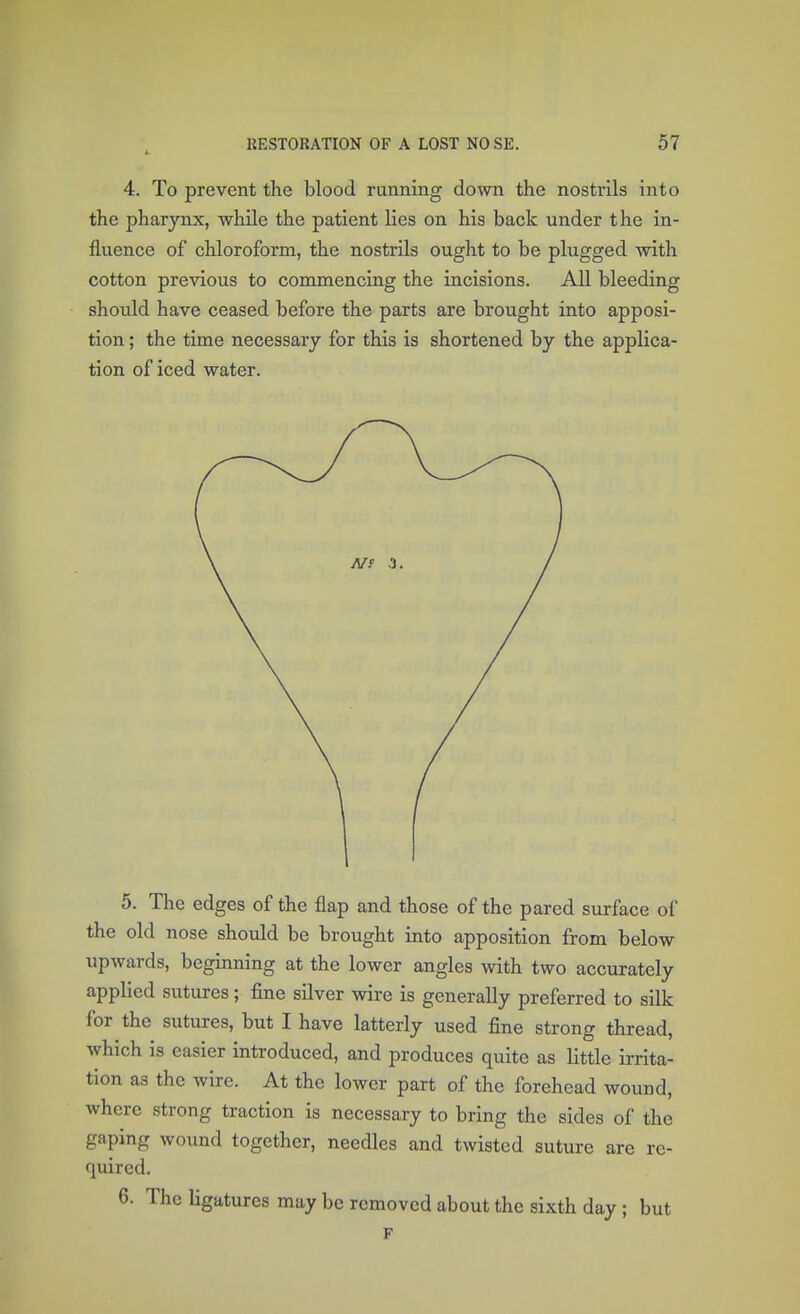 4, 4. To prevent the blood running down the nostrils into the pharynx, while the patient lies on his back under the in- fluence of chloroform, the nostrils ought to be plugged with cotton previous to commencing the incisions. All bleeding should have ceased before the parts are brought into apposi- tion ; the time necessary for this is shortened by the applica- tion of iced water. 5. The edges of the flap and those of the pared surface of the old nose should be brought into apposition from below upwards, beginning at the lower angles with two accurately applied sutures; fine silver wire is generally preferred to silk for the sutures, but I have latterly used fine strong thread, which is easier introduced, and produces quite as little irrita- tion as the wire. At the lower part of the forehead wound, where strong traction is necessary to bring the sides of the gaping wound together, needles and twisted suture are re- quired. 6. The ligatures may be removed about the sixth day ; but F