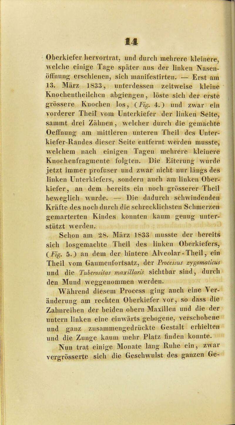 Oberkiefer hervortrat, und durch mehrere kleinere, welche einige Tage später aus der linken Nasen- öfFnung erschienen, sich manifestirten. — Erst am 13. März 1833, unterdessen zeitweise kleine Knochentheilchcn abgiengen, löste sich der erste grössere Knochen los, 4.) und zwar ein vorderer Theit vom Unterkiefer der linken Seite, sammt drei Zähnen, welcher durch die gemachte Oeffnung am mittleren unteren Theil des Unter- kiefer-Randes dieser Seite entfernt werden musste, welchem nach einigen Tagen mehrere kleinere Knochenfragmente folgten. Die Eiterung wurde jetzt immer profuser und zwar nicht nur längs des linken Unterkiefers, sondern auch am linken Ober- kiefer, an dem bereits ein noch grösserer Theil beweglich wurde. — Die dadurch schwindenden Kräfte des noch durch die schrecklichsten Schmerzen gemarterten Kindes konnten kaum genug unter- stützt werden. Schon am 28. März 1833 musste der bereits sich losgemachte Theil des linken Oberkiefers, (Fig. 5.) an dem der hintere Alveolar-Theil, ein Theil vom Gaumenfortsatz, der Processus zygomaiicus und die Tuberosiias maxillaris sichtbar sind, durch den Mund weggenommen werden. Während diesem Process ging auch eine Ver- änderung am rechten Oberkiefer vor, so dass die Zahnreihen der beiden obern Maxillen und die der untern linken eine einwärts gebogene, verschobene und ganz zusammengedrückte Gestalt erhielten und die Zunge kaum mehr Platz finden konnte. Nun trat einige Monate lang Ruhe ein, zwar vergrösserte sich die Geschwulst des ganzen Ge-