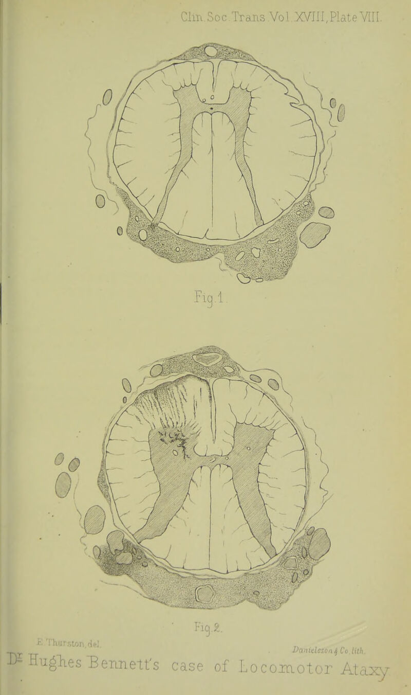 I Clni Soc.Trans Vo 1 XVIII,Plate YIII.