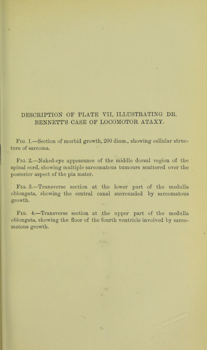 DESCRIPTION OF PLATE VII, ILLUSTRATING DR. BENNETT'S CASE OF LOCOMOTOR ATAXY. Fig. 1.—Section of morbid growth, 200 diam., showing cellular struc- ture of sarcoma. Fig. 2.—Naked-eye appearance of the middle dorsal region of the spinal cord, showing multiple sarcomatoiis tumours scattered over the posterior aspect of the pia mater. Fig. 3.—Transverse section at the lower part of the medulla oblongata, showing the central canal surrounded by sarcomatous growth. Fig. 4.—Transverse section at the upper part of the medulla oblongata, showing the floor of the fourth ventricle involved by sarco- matous growth.