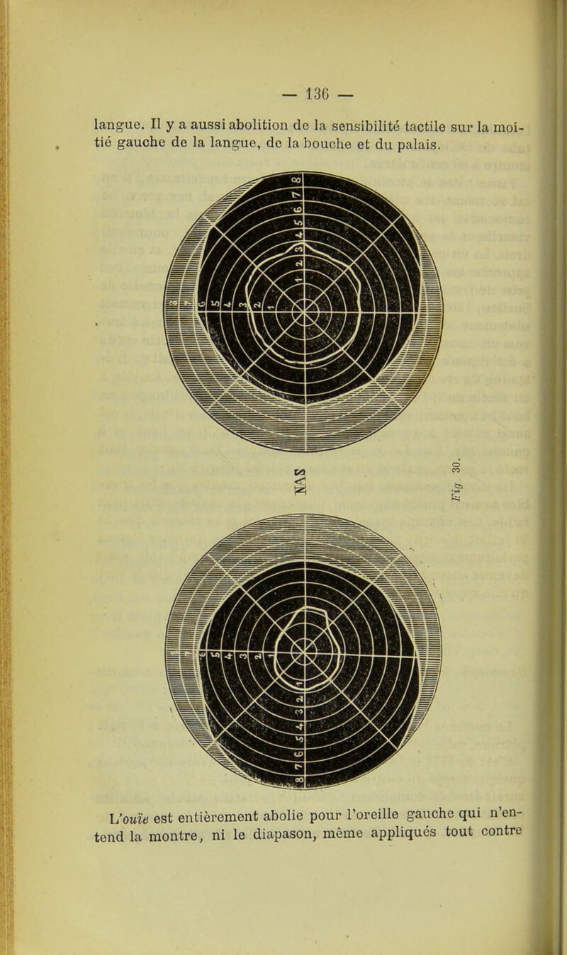 — 13G — langue. Il y a aussi abolition de la sensibilité tactile sur la moi- tié gauche de la langue, de la bouche et du palais. h'ouïe est entièrement abolie pour l'oreille gauche qui n'en- tend la montre, ni le diapason, même appliqués tout contre