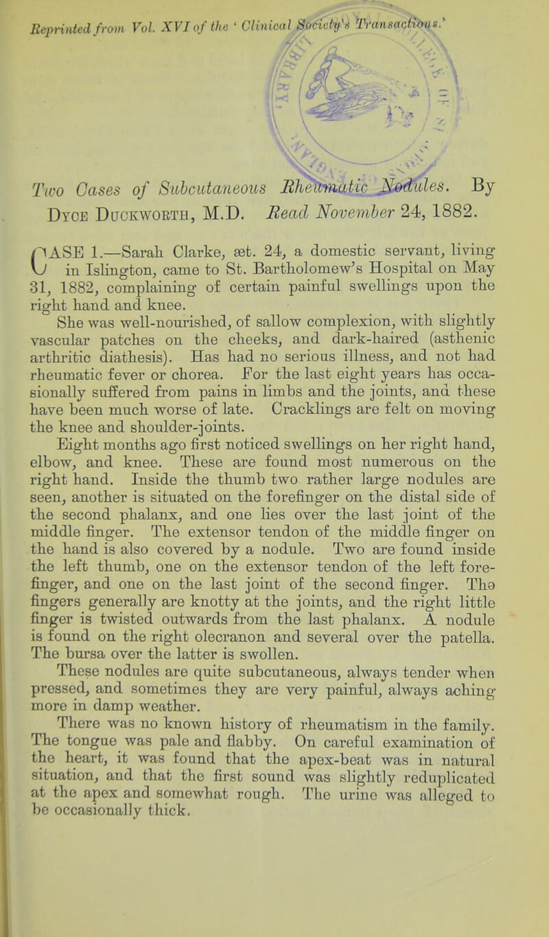 Reprinted from Vol XVI of the • Clinical SucidyjiJ'ruii^aQpl^' Two Gases of Subcutaneous BJmhnatic^^^^^les. By Dyce Duckworth, M.D. Bead November 24,1882. C^SE 1.—Sarah Clarke, aet. 24, a domestic servant, living- in Islington, came to St. Bartholomew's Hospital on May 31, 1882, complaining of certain painful swellings upon the right hand and knee. She was well-nourished, of sallow complexion, with slightly vascular patches on the cheeks, and dark-haired (asthenic arthritic diathesis). Has had no serious illness, and not had rheumatic fever or chorea. For the last eight years has occa- sionally suffered from pains in limbs and the joints, and these have been much worse of late. Cracklings are felt on moving the knee and shoulder-joints. Eight months ago first noticed swelHngs on her right hand, elbow, and knee. These are found most numerous on the right hand. Inside the thumb two rather large nodules are seen, another is situated on the forefinger on the distal side of the second phalanx, and one lies over the last joint of the middle finger. The extensor tendon of the middle finger on the hand is also covered by a nodule. Two are found inside the left thumb, one on the extensor tendon of the left fore- finger, and one on the last joint of the second finger. The fingers generally are knotty at the joints, and the right little finger is twisted outwards from the last phalanx. A nodule is found on the right olecranon and several over the patella. The bursa over the latter is swollen. These nodules are quite subcutaneous, always tender when pressed, and sometimes they are very painful, always aching- more in damp weather. There was no known history of rheumatism in the family. The tongue was pale and flabby. On careful examination of the heart, it was found that the apex-beat was in natural situation, and that the first sound was slightly reduplicated at the apex and somewhat rough. The urine was alleged to be occasionally thick.