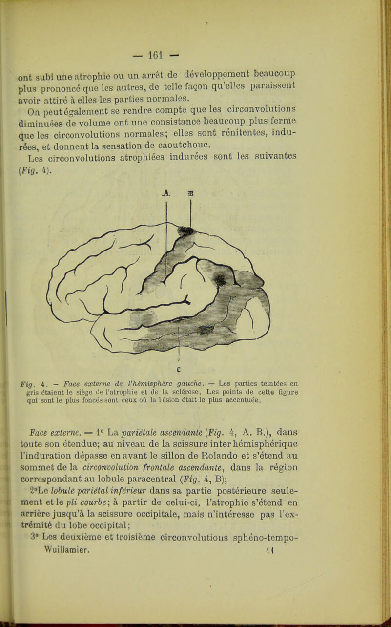 — IGl — ont subi une atrophie ou un arrêt de développement beaucoup plus prononce que les autres, de telle façon qu'elles paraissent avoir attiré à elles les parties normales. On peut également se rendre compte que les circonvolutions diminuées de volume ont une consistance beaucoup plus ferme que les circonvolutions normales; elles sont rénitentcs, indu- rées, et donnent la sensation de caoutchouc. Les circonvolutions atrophiées indurées sont les suivantes (Fig. 4). A. -S c Fig. 4. — Face externe de l'hémisphère gauche. — Les parties teintées en gris étaient le siège i-e l'atrophie et de la sclérose. Les points de cette figure qui sont le plus fonces sont ceux où la lésion était le plus accentuée. Face externe. — 1 La pariétale ascendante {Fig. 4, A. B.), dans toute son étendue; au niveau de la scissure inter hémisphérique l'induration dépasse en avant le sillon de Rolando et s'étend au sommet de la circonvolution frontale ascendante, dans la région correspondant au lobule paracentral (Fig. 4, B); 2''Le lobule pariétal inférieur dans sa partie postérieure seule- ment et le pli courbe; h partir de celui-ci, l'atrophie s'étend en arrière jusqu'à la scissure occipitale, mais n'intéresse pas l'ex- trémité du lobe occipital; 3» Les deuxième et troisième circonvolutions sphéno-tempo- Wuillamier. 11