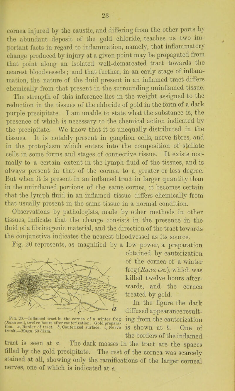 cornea injured by the caustic, and differing from tlie other parts by the abundant deposit of the gold chloride, teaches us two im- portant facts in regard to inflammation, namely, that inflammatory change produced by injury at a given point may be propagated from that ])oint along an isolated well-demarcated tract towards the nearest bloodvessels ; and that further, in an early stage of inflam- mation, the nature of the fluid present in an inflamed tract differs chemically from that present in the surrounding uninflamed tissue. The strength of this inference lies in the weight assigned to the reduction in the tissues of the chloride of gold in the form of a dark purple precipitate. I am unable to state what the substance is, the presence of which is necessary to the chemical action indicated by the precipitate. We know that it is unequally distributed in the tissues. It is notably present in ganglion cells, nerve fibres, and in tlie protoplasm which enters into the composition of stellate cells in some forms and stages of connective tissue. It exists nor- mally to a certain extent in the lymph fluid of the tissues, and is always present in that of the cornea to a greater or less degree. But when it is present in an inflamed tract in larger quantity than in the uninflamed portions of the same cornea, it becomes certain that the lymph fluid in an inflamed tissue differs chemically from that usually present in the same tissue in a normal condition. Observations by pathologists, made by other methods in other tissues, indicate that the change consists in the presence in the fluid of a fibrinogenic material, and the direction of the tract towards the conjunctiva indicates the nearest bloodvessel as its source. Fig. 20 represents, as magnified by a low power, a preparation obtained by cauterization of the cornea of a winter frog {Rana esc), which was killed twelve hours after- wards, and the cornea treated by gold. In the figure the dark diffused appearance result- Fio. 20.-InfIame<l tract in the comca of a winter frog ing frOm the Cauterization (/fi/ia ««<;.), twelve hours after cauterization. Gold prepnra- . tion. a, Bordi-r of tract, b, Cauterized surface, c, Nerve IS shoWU at b One of trunk.—Magii. 50 diam. ■ --^ ^ the borders of the inflamed tract is seen at a. The dark masses in the tract are the spaces filled by the gold precipitate. The rest of the cornea was scarcely stained at all, showing only the ramifications of the larger corneal nerves, one of which is indicated at c.