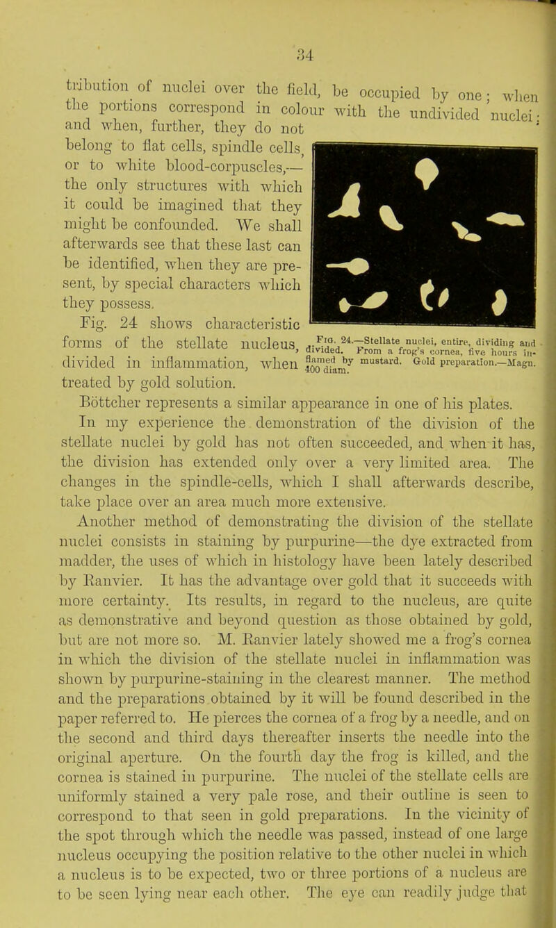 tribution of nuclei over the field, be occupied by one • wb,-,) the portions correspond in colour with the undivided 'nuclei ■ and when, further, they do not belong to flat cells, spindle cells, or to white blood-corpuscles,— the only structures with which it could be imagined that they might be confounded. We shall afterwards see that these last can be identified, when they are pre- sent, by special characters which they possess. Fig. 24 shows characteristic forms of the stellate nucleus .^''■-Stellate nu. lei, entiri- dlvidins; and I divided, j-rom a fro}; s cornea, hve hours iii- divided in inflammation, when foo'diim^ mustard. GuM preparation.—Magu. treated by gold solution. Bottcher represents a similar appearance in one of his plates. In my experience the demonstration of the diA'ision of the stellate nuclei by gold has not often succeeded, and when it has, the division has extended only over a very limited area. The changes in the spindle-cells, which I shall afterwards describe, take place over an area much more extensive. Another method of demonstrating the division of the stellate nuclei consists in staining by purpurine—the dye extracted from madder, the uses of which in histology have been lately described by Kanvier. It has the advantage over gold that it succeeds with more certainty. Its results, in regard to the nucleus, are quite as demonstrative and beyond question as those obtained by gold, but are not more so. M. Eanvier lately showed me a frog's cornea in which the division of the stellate nuclei in inflammation was shown by purpurine-staining in the clearest manner. The method and the preparations obtained by it wiU be found described in the paper referred to. He pierces the cornea of a frog by a needle, and on the second and third days thereafter inserts the needle into the original aperture. On the fourth day the frog is killed, and the cornea is stained in purj)urine. The nuclei of the stellate cells are uniformly stained a very pale rose, and their outline is seen to correspond to that seen in gold preparations. In the vicinity of the spot through which the needle was passed, instead of one large nucleus occupying the position relative to the other nuclei in which a nucleus is to be expected, two or three portions of a nucleus are to be seen lying near each other. The eye can readily judge that