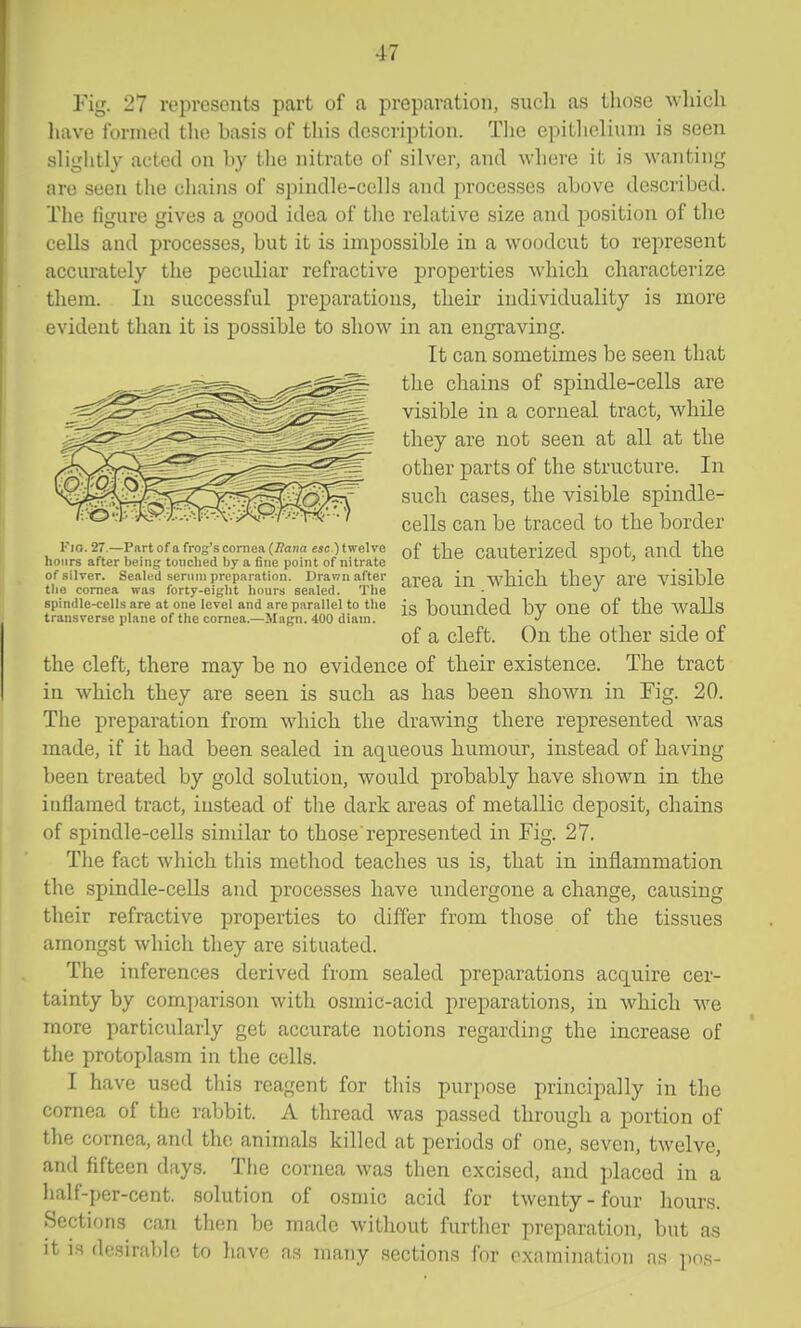 Fig. 27 represents part of a preparation, sucli as those which have formed tlie basis of this description. Tlie e]iitlielium is seen sliglitly acted on by the nitrate of silver, and where it is wanting are seen the chains of spindle-cells and processes above described. The fignre gives a good idea of the relative size and position of the cells and processes, but it is impossible in a woodcut to represent accurately the peculiar refractive properties which characterize them. In successful preparations, their individuality is more evident than it is possible to show in an engraving. It can sometimes be seen that tlie chains of spindle-cells are visible in a corneal tract, while they are not seen at all at the other parts of the structure. In such cases, the visible spindle- cells can be traced to the border !• 10.27.-Partofa frog's cornea (;?anaejO twelve j^]^Q cautCrized SpOt, and the hours after being touched by a fine point of nitrate ^ ' of silver. Sealed scriini preparation. Drawn after gj.Q^ wMch theV are visible tlie cornea was forty-eight hours sealed. The - spindle-cells are at one level and are parallel to the ig hounded bv OUe of the Walls transverse plane of the cornea.—Magn. 400 diam. of a cleft. On the other side of the cleft, there may be no evidence of their existence. The tract in which they are seen is such as has been shoAvn in Fig. 20. The preparation from which the drawing there represented was made, if it had been sealed in aqueous humour, instead of having been treated by gold solution, would probably have shown in the inflamed tract, instead of the dark areas of metallic deposit, chains of spindle-cells similar to those represented in Fig. 27. The fact which this method teaches us is, that in inflammation the spindle-cells and processes have undergone a change, causing their refractive properties to differ from those of the tissues amongst which they are situated. The inferences derived from sealed preparations acquire cer- tainty by comparison with osmic-acid preparations, in which we more particularly get accurate notions regarding the increase of the protoplasm in the cells. I have used this reagent for tliis purpose principally in the cornea of the rabbit. A thread was passed through a portion of the cornea, and the animals killed at periods of one, seven, twelve, and fifteen days. The cornea was then excised, and placed in a half-per-cent. solution of osmic acid for twenty-four hours. Sections can then be made without furtlier preparation, but as it IS desirable to liavo as inany sections for oxnminatimi ns ]in,s-