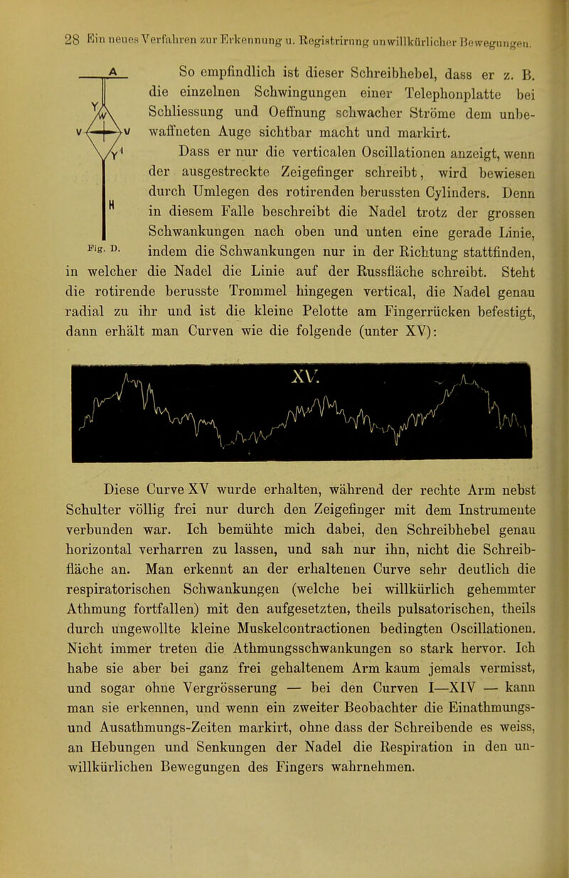 igungen. V A V So empfindlich ist dieser Schreibhebel, dass er z. B. die einzelnen Schwingungen einer Telephonplatte bei Schliessung und Oefi'nung schwacher Ströme dem unbe- wafineten Auge sichtbar macht und markirt. Dass er nur die verticalen Oscillationen anzeigt, wenn der ausgestreckte Zeigefinger schreibt, wird bewiesen durch Umlegen des rotirenden berussten Cylinders. Denn in diesem Falle beschreibt die Nadel trotz der grossen Schwankungen nach oben und unten eine gerade Linie, indem die Schwankungen nur in der Richtung stattfinden. in welcher die Nadel die Linie auf der Russfläche schreibt. Steht die rotirende berusste Trommel hingegen vertical, die Nadel genau radial zu ihr und ist die kleine Pelotte am Fingerrücken befestigt, dann erhält man Curven wie die folgende (unter XV): Diese Curve XV wurde erhalten, während der rechte Arm nebst Schulter völlig frei nur durch den Zeigefinger mit dem Instrumente verbunden war. Ich bemühte mich dabei, den Schreibhebel genau horizontal verharren zu lassen, und sah nur ihn, nicht die Schreib- fläche an. Man erkennt an der erhaltenen Curve sehr deutlich die respiratorischen Schwankungen (welche bei willkürlich gehemmter Athmung fortfallen) mit den aufgesetzten, theils pulsatorischen, theils durch ungewollte kleine Muskelcontractionen bedingten Oscillationen. Nicht immer treten die Athmungsschwankungen so stark hervor. Ich habe sie aber bei ganz frei gehaltenem Arm kaum jemals vermisst, und sogar ohne Vergrösserung — bei den Curven I—XIV — kann man sie erkennen, und wenn ein zweiter Beobachter die Einathmungs- und Ausathmungs-Zeiten markirt, ohne dass der Schreibende es weiss, an Hebungen und Senkungen der Nadel die Respiration in den un- willkürlichen Bewegungen des Fingers wahrnehmen.