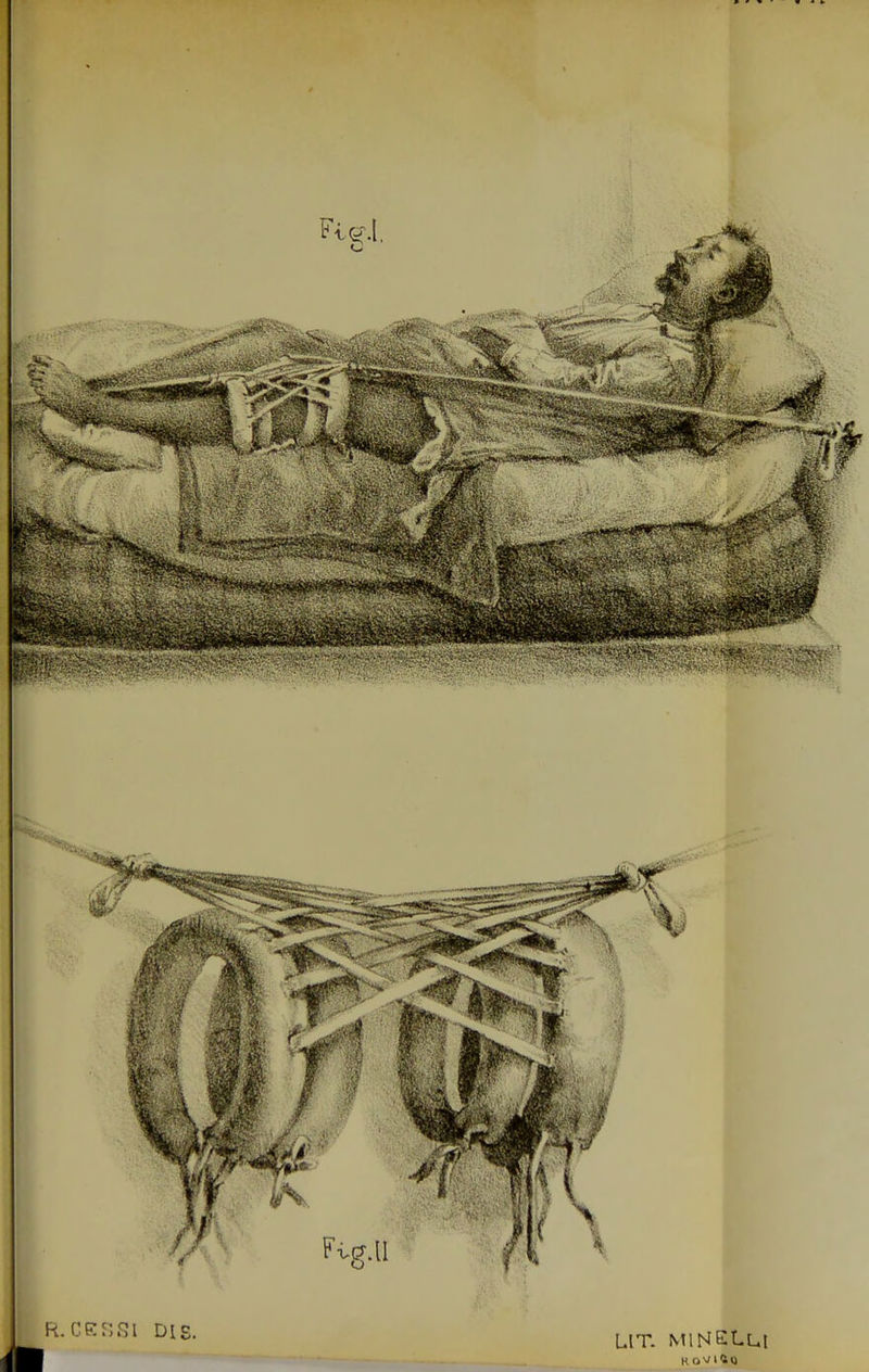 R. CPinni DIS. LIT. MlNELn