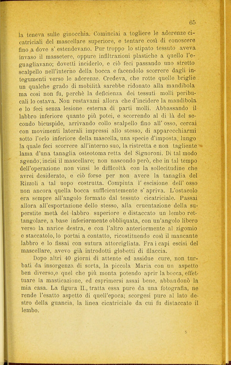 la teneva sulle ginocchia. Cominciai a togliere le aderenze ci- catriciali del mascellare superiore, e tentare cosi di conoscere fino a dove s' estendevano. Pur troppo lo stipato tessuto aveva invaso il massetere, oppure infiltrazioni plastiche a quello l'e- guagliavano; dovetti inciderlo, e ciò feci passando uno stretto scalpello nell'interno della bocca e facendolo scorrere dagli in- tegumenti verso le aderenze. Credeva, che rotte quelle briglie un qualche grado di mobilità sarebbe ridonato alla mandibola ma cosi non fu, perchè la deficienza dei tessuti molli peribu- cali lo ostava. Non restavami allora che d'incidere la mandibola e lo feci senza lesione esterna di parti molli. Abbassando il labbro inferiore quanto più potei, e scorrendo al di là del se- condo bicuspide, arrivando collo scalpello fino all' osso, cercai con movimenti laterali impressi allo stesso, di apparecchiarmi sotto l'orlo inferiore della mascella, una specie d'imposta, lungo la quale feci scorrere all'interno suo, la ristretta e non tagliente '* lama d'una tanaglia osteotoma retta del Signoroni. Di tal modo agendo, incisi il mascellare; non nascondo però, che in tal tempo dell'operazione non vinsi le difficoltà con la sollecitudine che avrei desiderato, e ciò forse per non avere la tanaglia del Rizzoh a tal uopo costrutta. Compiuta 1' escisione dell' osso non ancora quella bocca sufficientemente s' apriva. L'ostacolo era sempre all'angolo formato dal tessuto cicatriciale. Passai allora all'esportazione dello stesso, alla cruentazione della su- perstite metà del labbro superiore e distaccato un lembo ret- tangolare, a base inferiormente obbliquata, con un'angolo hbero verso la narice destra, e con l'altro anteriormente al zigomio e staccatolo, lo portai a contatto, ricostituendo cosi il mancante labbro e lo fissai con sutura attorcigliata. Fra i capi escisi del mascellare, avevo già introdotti globetti di filaccia. Dopo altri 40 giorni di attente ed assidue cure, non tur- bati da insorgenza di sorta, la piccola Maria con un aspetto ben diverso,e quel che più monta potendo aprir la bocca, effet- tuare la masticazione, ed esprimersi assai bene, abbandonò la mia casa. La figura IL, tratta essa pure da una fotografia, ne rende l'esatto aspetto di quell'epoca; scorgesi pure al lato de- stro della guancia, la linea cicatriciale da cui fu distaccato il lembo.