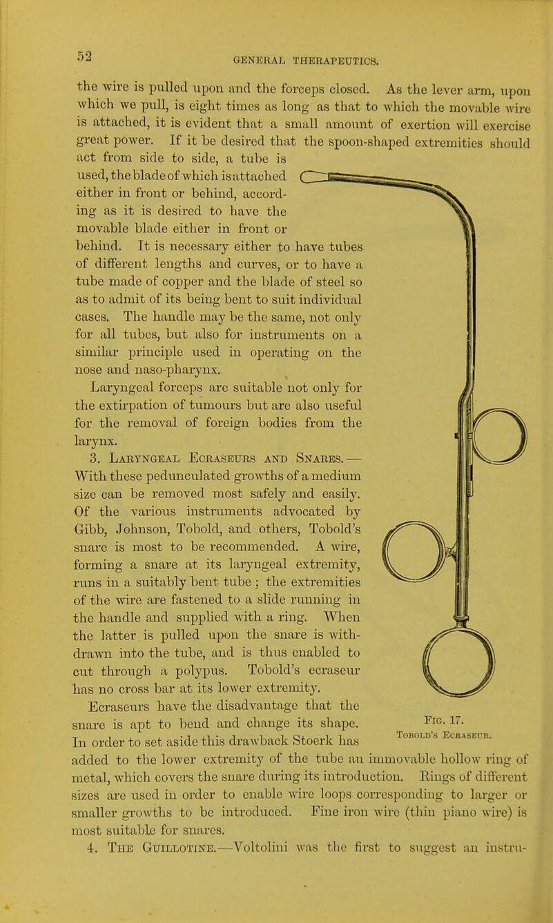 GENERAL THERAPEUTICS. the wire is pulled upon and the forceps closed. As the lever arm, upon which we pull, is eight times as long as that to which the movable wire is attached, it is evident that a small amount of exertion will exercise great power. If it be desired that the spoon-shaped extremities should act from side to side, a tube is used, the blade of which is attached either in front or behind, accord- ing as it is desired to have the movable blade either in front or behind. It is necessary either to have tubes of different lengths and curves, or to have a tube made of copper and the blade of steel so as to admit of its being bent to suit individual cases. The handle may be the same, not only for all tubes, but also for instruments on a similar principle used in operating on the nose and naso-pharynx. Laryngeal forceps are suitable not only for the extirpation of tumours but are also useful for the removal of foreign bodies from the laiynx. 3. Laryngeal Ecraseurs and Snares.— With these pedunculated growths of a medium size can be removed most safely and easily. Of the various instruments advocated by Gibb, Johnson, Tobold, and others, Tobold's snare is most to be recommended. A wire, forming a snare at its laryngeal extremity, runs in a suitably bent tube ; the extremities of the wire are fastened to a slide running in the handle and supplied with a ring. When the latter is pulled upon the snare is with- drawn into the tube, and is thus enabled to cut through a polypus. Tobold's ecraseur has no cross bar at its lower extremity. Ecraseurs have the disadvantage that the snare is apt to bend and change its shape. In order to set aside this drawback Stoerk has added to the lower extremity of the tube an immovable hollow ring of metal, which covers the snare during its introduction. Rings of different sizes are used in order to enable wire loops corresponding to larger or smaller growths to be introduced. Fine iron wire (thin piano wire) is most suitable for snares. 4. The Guillotine.—Voltolini was tlic first to suggest an instru- FiG. 17. Tobold's Ecraseur.