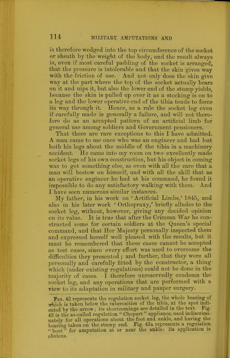 13 therefore wedged into the top circumference of the socket or sheath by the weight of the body, and the result always is^ even if most careful padding of the socket is arranged, that the pressure is intolerable and that the skin gives way with the friction of use. . And not only does the skin give way at the part where the top of the socket actually bears on it and nips it, but also the lower end of the stump yields, because the skin is pulled up over it as a stocking is on to a leg and the lower operative end of the tibia tends to force its way through it. Hence, as a rale the socket leg even if carefully made is generally a failure, and will not there- fore do as an accepted pattern of an artificial limb for general use among soldiers and Government pensioners. That there are rare exceptions to this I have admitted. A man came to me once who was an engineer and had lost both his legs about the middle of the tibia in a machinery accident. He came into my room on two excellently made socket legs of his own construction, but his object in coming was to get something else, as even with all the care that a man will bestow on himself, and with all the skill that as an operative engineer he had at his command, he found it impossible to do any satisfactory walking with them. And I have seen numerous similar instances. My father, in his work on ^Ai'tificial Limbs/ 1845, and also in his later work ' Orthopraxy,' briefly alludes to the socket leg, without, however, giving any decided opinion on its value. It is true that after the Crimean War he con- structed some for certain soldiers at the Queen's special command, and that Her Majesty personally inspected them and expressed herself well pleased Avith the results, but it must be remembered that these cases cannot be accepted as test cases, since every effort was used to overcome the difficulties they presented; and further, that they were all personally and carefully fitted by the constructor, a thing which (under existing regulations) could not be done in the majority of cases. I therefore unreservedly condemn the socket leg, and any operations that are performed with a view to its adaptation in military and pauper surgery. Pig. 42 represents the regulation socket leg, the whole bearing of ■which is taken below the tuberosities of the tibia, at the spot indi- cated by the arrow ; its shortcomings are detailed in the text. Fig. 43 is the so-called regulation  Ohopart appliance, used indiscrimi- nately for all operations about the foot and ankle, and having the bearing taken on the stump end. Fig. 43a represents a regulation boot for amputation at or near the ankle: its application is obvious.