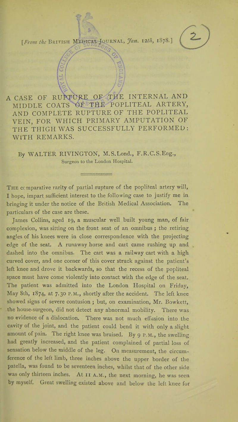 r/vw/////c-British Mkuical Jqijrnal, 7««. 12///, 1S78.] (9 A CASE OF RUKFtm£_aF-trHE INTERNAL AND MIT3DLE COATS 6F TriE POPLITEAL ARTERY, AND COMPLETE RUPTURE OF THE POPLITEAL VEIN, FOR WHICH PRIMARY AMPUTATION OF THE THIGH WAS SUCCESSFULLY PERFORMED: WITH REMARKS. By WALTER RIVINGTON, M.S.Lond., F.R.C.S.Eng., Surgeon to the London Hospital. The cf mparative rarity of partial rupture of the popliteal artery will, I hope, impart sufficient interest to the following case to justify me in bringing it under the notice of the British Medical Association. The particulars of the case are these. James Collins, aged 19, a muscular well built young man, of fair complexion, was sitting on the front seat of an omnibus ; the retiring angles of his knees were in close correspondence with the projecting edge of the seat. A runaway horse and cait came rushing up and dashed into the omnibus. The cart was a railway cart with a high curved cover, and one corner of this cover struck against the patient's left knee and drove it backwards, so that the recess of the popliteal space must have come violently into contact with the edge of the seat. The patient was admitted into the London Hospital on Friday, May 8ih, 1874, at 7.30 P.M., shortly after the accident. The left knee showed signs of severe contusion ; but, on examination, Mr. Bowkett, the house-surgeon, did not detect any abnormal mobility. There was no evidence of a dislocation. There was not much effusion into the cavity of the joint, and the patient could bend it with only a slight amount of pain. The right knee was bruised. By 9 p.m., the swelling had greatly increased, and the patient complained of partial loss of sensation below the middle of the leg. On measurement, the circum- ference of the left limb, three inches above the upper border of the patella, was found to be seventeen inches, whilst that of the other side was only thirteen inches. At 11 a.m., the next morning, he was seen by myself. Great swelling existed above and below the left knee for