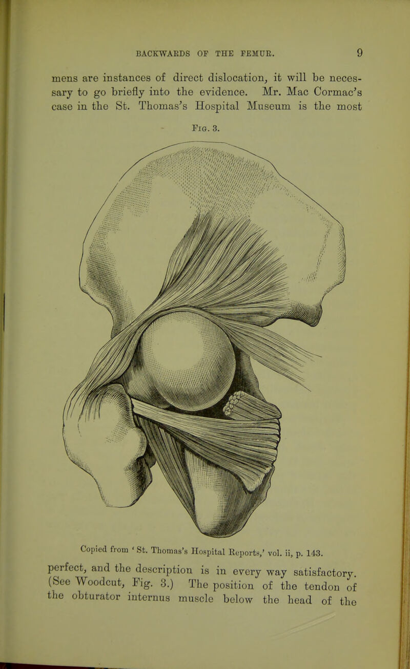 mens are instances of direct dislocation, it will be neces- sary to go briefly into the evidence. Mr, Mac Cormac's case in the St. Thomas's Hospital Museum is the most Fig. 3. Copied from ' St. Thomas's Hospital Reports,' vol. ii, p. 143. perfect, and the description is in every way satisfactory (See Woodcut, Fig. 3.) The position of the tendon of the obturator internus muscle below the head of the