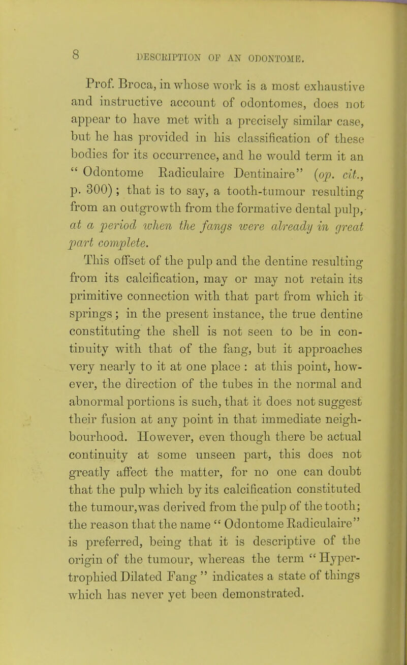 Prof. Broca, in whose work is a most exhaustive and instructive account of odontomes, does not appear to have met with a precisely similar case, but he has provided in his classification of these bodies for its occurrence, and he would term it an  Odontorae Eadiculaire Dentinaire (op. cit., p. 300); that is to say, a tooth-tumour resulting from an outgrowth from the formative dental pulp, at a period ivhen the fangs were already in great part complete. This offset of the pulp and the dentine resulting from its calcification, may or may not retain its primitive connection with that part from which it springs; in the present instance, the true dentine constituting the shell is not seen to be in con- tinuity with that of the fang, but it api^roaches very nearly to it at one place : at this point, how- ever, the direction of the tubes in the normal and abnormal portions is such, that it does not suggest their fusion at any point in that immediate neigh- bourhood. However, even though there be actual continuity at some unseen -part, this does not greatly affect the matter, for no one can doubt that the pulp which by its calcification constituted the tumour,was derived from the pulp of the tooth; the reason that the name  Odontome Radiculaire is preferred, being that it is descriptive of the origin of the tumour, whereas the term  Hyper- trophied Dilated Fang  indicates a state of things which has never yet been demonstrated.