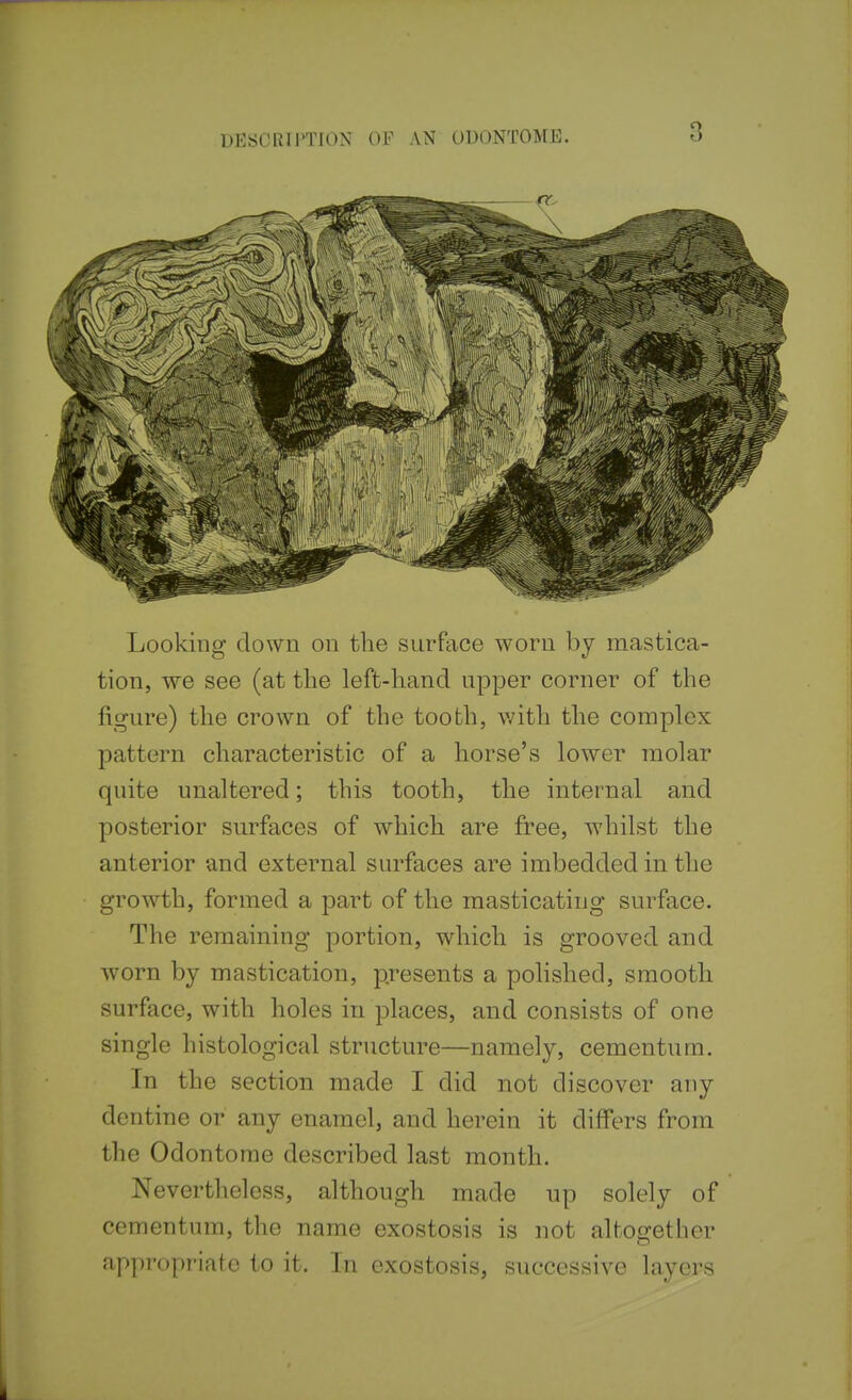 Looking down on the surface worn by mastica- tion, we see (at the left-hand upper corner of the figure) the crown of the tooth, v/ith the complex pattern characteristic of a horse's lower molar quite unaltered; this tooth, the internal and posterior surfaces of which are free, whilst the anterior and external surfaces are imbedded in the growth, formed a part of the masticating surface. The remaining portion, which is grooved and worn by mastication, presents a pohshed, smooth surface, with holes in places, and consists of one single histological structure—namely, cementum. In the section made I did not discover any dentine or any enamel, and herein it differs from the Odontome described last month. Nevertheless, although made up solely of cementum, the name exostosis is not altogether appropriate to it. In exostosis, successive layers
