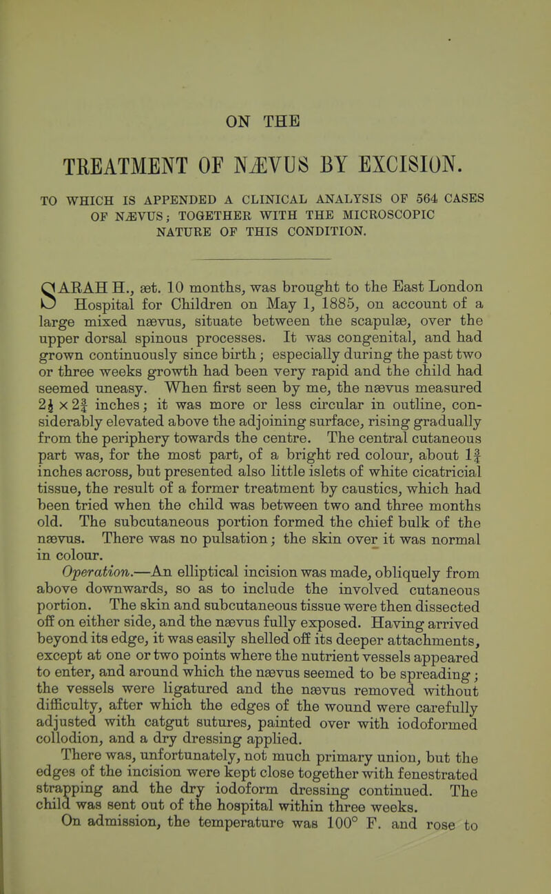 ON THE TREATMENT OF NiEVUS BY EXCISION. TO WHICH IS APPENDED A CLINICAL ANALYSIS OF 564 CASES OF NiEVUS; TOGETHER WITH THE MICROSCOPIC NATURE OF THIS CONDITION. SARAH H., aet. 10 montlis, was brought to the East London Hospital for Children on May 1^ 1885_, on account of a large mixed nsevus, situate between the scapulae, over the upper dorsal spinous processes. It was congenital, and had grown continuously since birth; especially during the past two or three weeks growth had been very rapid and the child had seemed uneasy. When first seen by me, the neevus measured 2J x2| inches; it was more or less circular in outline, con- siderably elevated above the adjoining surface, rising gradually from the periphery towards the centre. The central cutaneous part was, for the most part, of a bright red colour, about If inches across, but presented also little islets of white cicatricial tissue, the result of a former treatment by caustics, which had been tried when the child was between two and three months old. The subcutaneous portion formed the chief bulk of the naevus. There was no pulsation; the skin over it was normal in colour. Operation.—An elliptical incision was made, obliquely from above downwards, so as to include the involved cutaneous portion. The skin and subcutaneous tissue were then dissected off on either side, and the naevus fully exposed. Having arrived beyond its edge, it was easily shelled off its deeper attachments, except at one or two points where the nutrient vessels appeared to enter, and around which the nasvus seemed to be spreading; the vessels were ligatured and the naevus removed without difficulty, after which the edges of the wound were carefully adjusted with catgut sutures, painted over with iodoformed collodion, and a dry dressing applied. There was, unfortunately, not much primary union, but the edges of the incision were kept close together with fenestrated strapping and the dry iodoform dressing continued. The child was sent out of the hospital within three weeks. On admission, the temperature was 100° F. and rose to