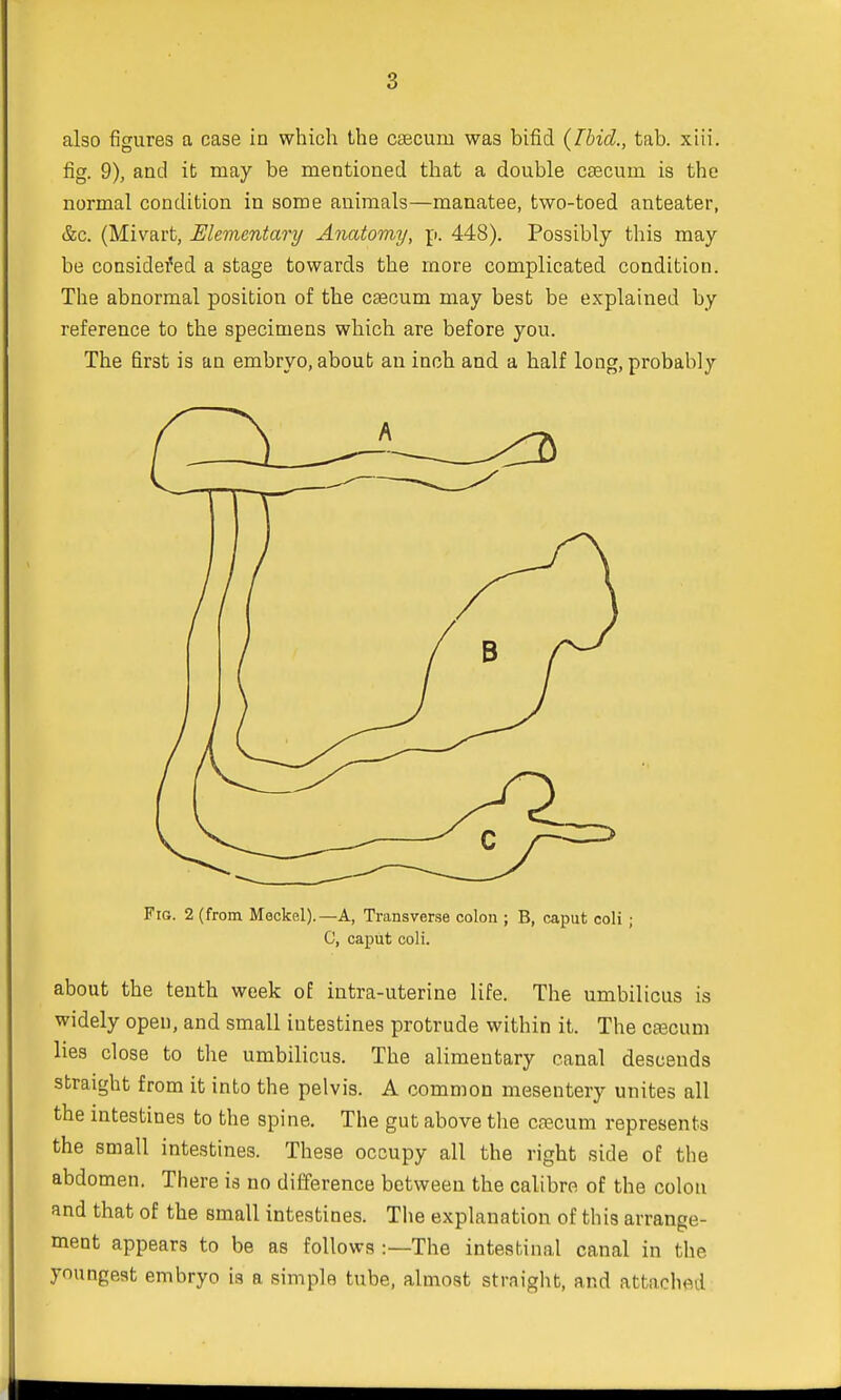 also figures a case in which the caecum was bifid {Ibid., tab. xiii. fig. 9), and it may be mentioned that a double caecum is the normal condition in some animals—manatee, two-toed anteater, &c. (Mivart, Elementary Anatomy, p. 448). Possibly this may be considered a stage towards the more complicated condition. The abnormal position of the caecum may best be explained by reference to the specimens which are before you. The first is an embryo, about an inch and a half long, probably Fig. 2 (from Meckel).—A, Transverse colon ; B, caput coli ; C, caput coli. about the tenth week of intra-uterine life. The umbilicus is widely open, and small intestines protrude within it. The cascum lies close to the umbilicus. The alimentary canal descends straight from it into the pelvis. A common mesentery unites all the intestines to the spine. The gut above the caecum represents the small intestines. These occupy all the right side of the abdomen. There is no difference between the calibre of the colon and that of the small intestines. The explanation of this arrange- ment appears to be as follows :—The intestinal canal in the youngest embryo is a simple tube, almost strnight, and attached