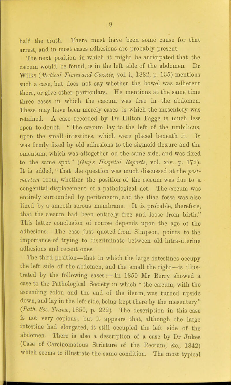 half the truth. There must have been some cause for that arrest, and in most cases adhesions are probably present. The next position in which it might be anticipated that the caecum would be found, is in the left side of the abdomen. Dr Wilks {Medical Times and Gazette, vol. i., 1882, p. 135) mentions such a case, but does not say whether the bowel was adherent there, or give other particulars. He mentions at the same time three cases in which the caecum was free in the abdomen. These may have been merely cases in which the mesentery was retained. A case recorded by Dr Hilton Fagge is much less open to doubt.  The caecum lay to the left of the umbilicus, upon the small intestines, which were placed beneath it. It was firmly fixed by old adhesions to the sigmoid flexure and the omentum, which was altogether on the same side, and was fixed to the same spot {Guy's Hospital Reports, vol. xiv. p. 172). It is added,  that the question was much discussed at the post- mortem room, whether the position of the cascum was due to a congenital displacement or a pathological act. The caecum was entirely surrounded by peritoneum, and the iliac fossa was also lined by a smooth serous membrane. It is probable, therefore, that the caecum had been entirely free and loose from birth. This latter conclusion of course depends upon the age of the adhesions. The case just quoted from Simpson, points to the importance of trying to discriminate between old intra-uterine adhesions and recent ones. The third position—that in which the large intestines occupy the left side of the abdomen, and the small the right—is illus- trated by the following cases:—In 1850 Mr Berry showed a case to the Pathological Society in which  the caecum, with the ascending colon and the end of the ileum, was turned upside down, and lay in the left side, being kept there by the mesentery  {Path. Soc. Trans., 1850, p. 222). The description in this case is not very copious; but it appears that, although the largo intestine had elongated, it still occupied the left side of the abdomen. There is also a description of a case by Dr Jukes (Case of Carcinomatous Stricture of the Rectum, &c, 1842) which seems to illustrate the same condition. The most typical