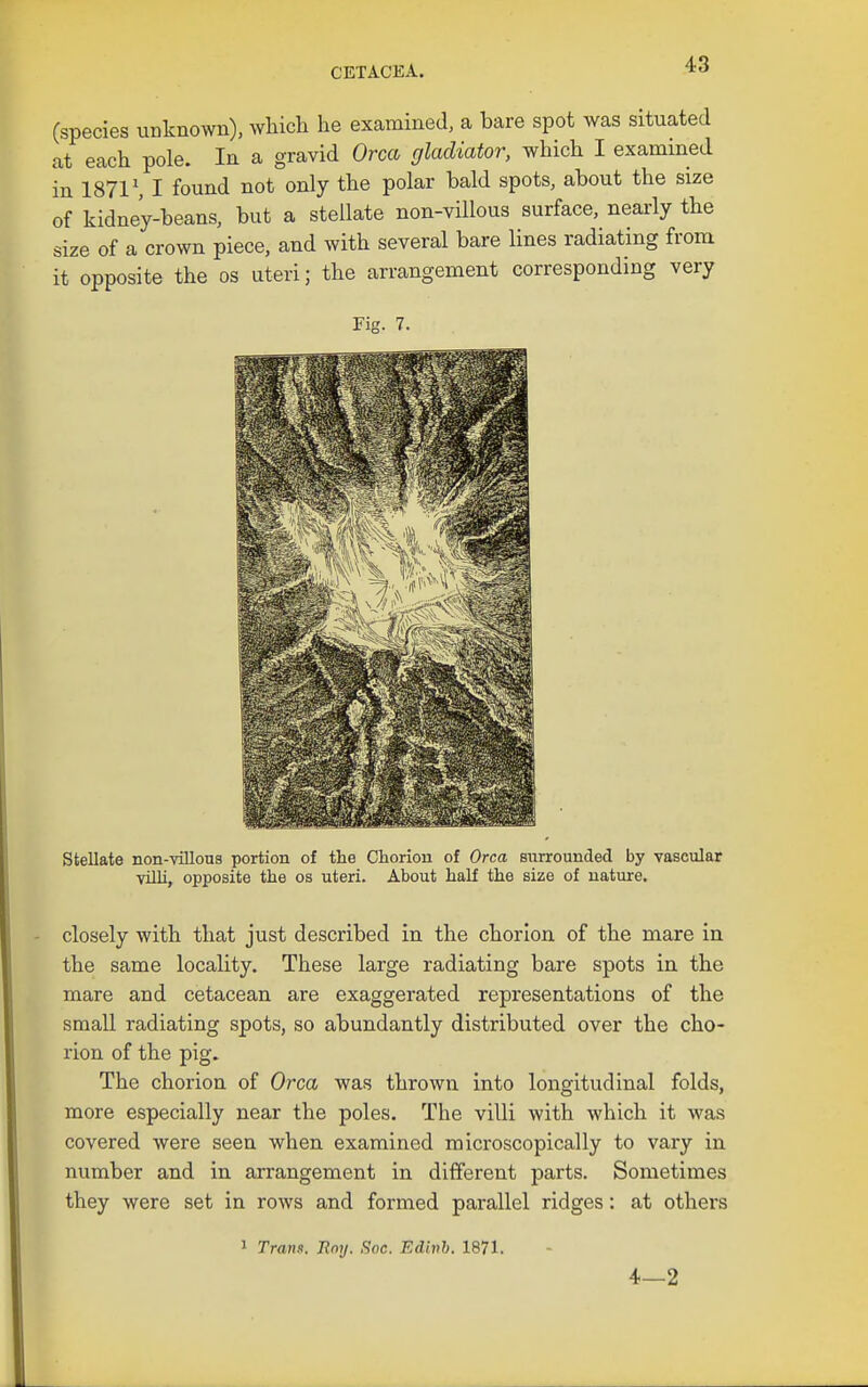 (species unknown), which he examined, a bare spot was situated at each pole. In a gravid Orca gladiator, which I examined in 1871 ^ I found not only the polar bald spots, about the size of kidney-beans, but a stellate non-villous surface, nearly the size of a crown piece, and with several bare lines radiating from it opposite the os uteri; the arrangement corresponding very FiK. 7. Stellate non-villons portion of the Clioriou of Orca surrounded by vascular villi, opposite the os uteri. About half the size of nature. closely with that just described in the chorion of the mare in the same locality. These large radiating bare spots in the mare and cetacean are exaggerated representations of the small radiating spots, so abundantly distributed over the cho- rion of the pig. The chorion of Orca was thrown into longitudinal folds, more especially near the poles. The villi with which it was covered were seen when examined microscopically to vary in number and in arrangement in different parts. Sometimes they were set in rows and formed parallel ridges: at others 1 Trans. Rmj. fioc. Edivb. 1871. 4—2