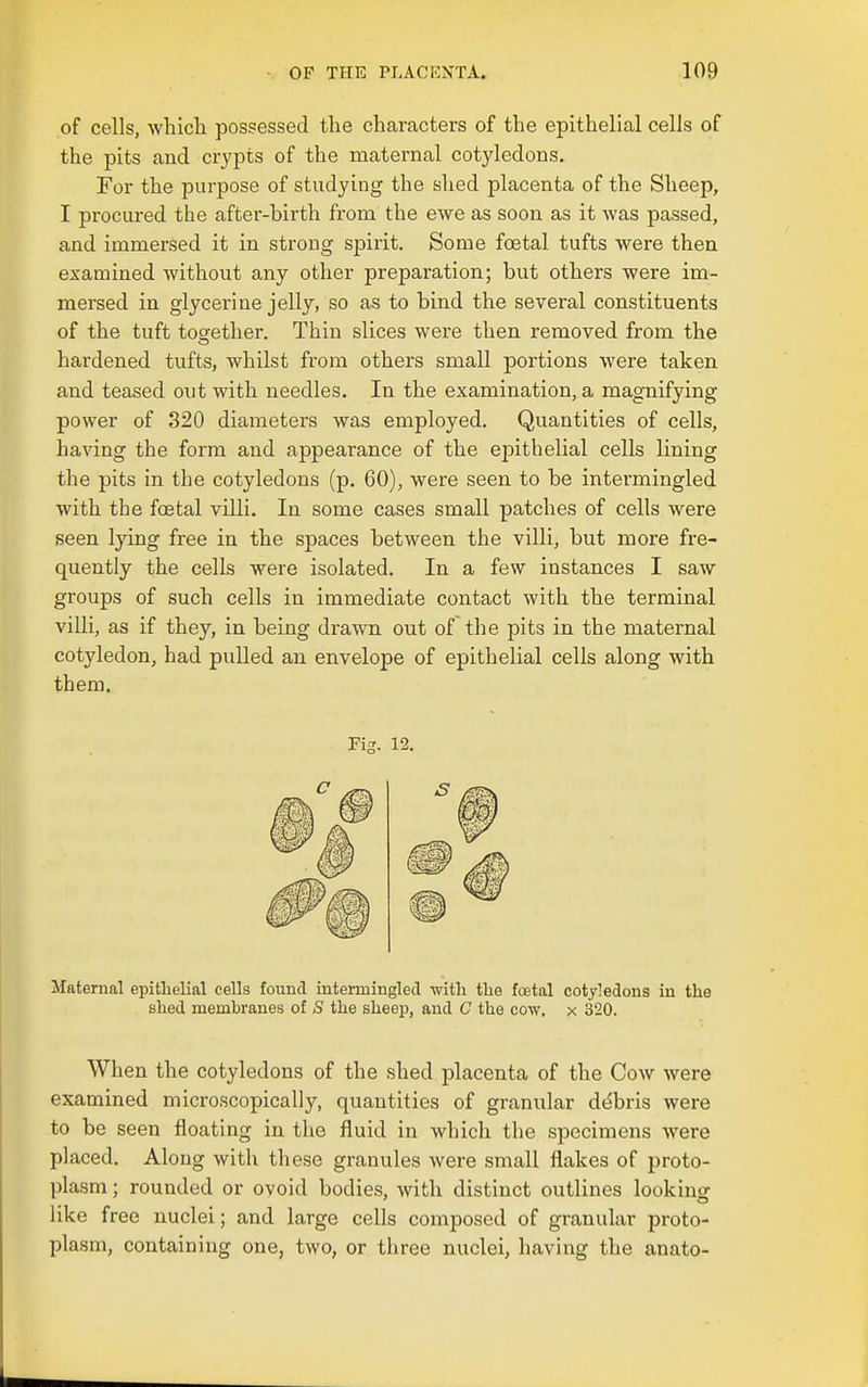 of cells, wliicli possessed the characters of the epithelial cells of the pits and crypts of the maternal cotyledons. For the purpose of studying the shed placenta of the Sheep, I procured the after-birth from the ewe as soon as it was passed, and immersed it in strong spirit. Some foetal tufts were then examined without any other preparation; but others were im- mersed in glycerine jelly, so as to bind the several constituents of the tuft together. Thin slices were then removed from the hardened tufts, whilst from others small portions were taken, and teased out with needles. In the examination, a magnifying power of 320 diameters was employed. Quantities of cells, having the form and appearance of the epithelial cells lining the pits in the cotyledons (p. 60), were seen to be intermingled with the foetal villi. In some cases small patches of cells were seen lying free in the spaces between the villi, but more fre- quently the cells were isolated. In a few instances I saw groups of such cells in immediate contact with the terminal villi, as if they, in being drawn out of the pits in the maternal cotyledon, had pulled an envelope of epithelial cells along with them. Fig. 12. Maternal epitlielial cells found intermingled vnth the foetal cotyledons in the shed membranes of S the sheep, and G the cow, x 320. When the cotyledons of the shed placenta of the Cow were examined microscopically, quantities of granular debris were to be seen floating in the fluid in which the specimens were placed. Along with these granules were small flakes of proto- plasm ; rounded or ovoid bodies, with distinct outlines looking like free nuclei; and large cells composed of granular proto- plasm, containing one, two, or three nuclei, having the anato-