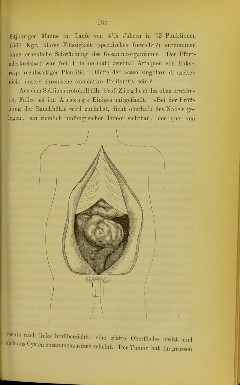 34jäbrigen Manne im Laufe von 4^2 Jahren in 92 Punktionen 1561 Kgr. klarer Flüssigkeit (specifisches Gewiclit?) entnommen olme erhebliche Schwächung des Gesammtorganismus. Der Pfort- aderkreislauf war frei, Urin normal; zweimal Attaquen von links-, resp. rechtsseitiger Pleuritis. Dürfte der »caso singolare di ascite« nicht unsere chronische exsudative Peritonitis sein ? Aus dem Sektionsprotokoll (Hr. Prof. Z i e g 1 e r) des oben erwähn- ten Falles sei im Auszuge Einiges mitgetheilt. »Bei der Eröff- nung der Bauchhöhle wird zunächst, dicht oberhalb des Nabels ge- legen , ein. ziemlich umfangreicher Tumor sichtbar , der quer von